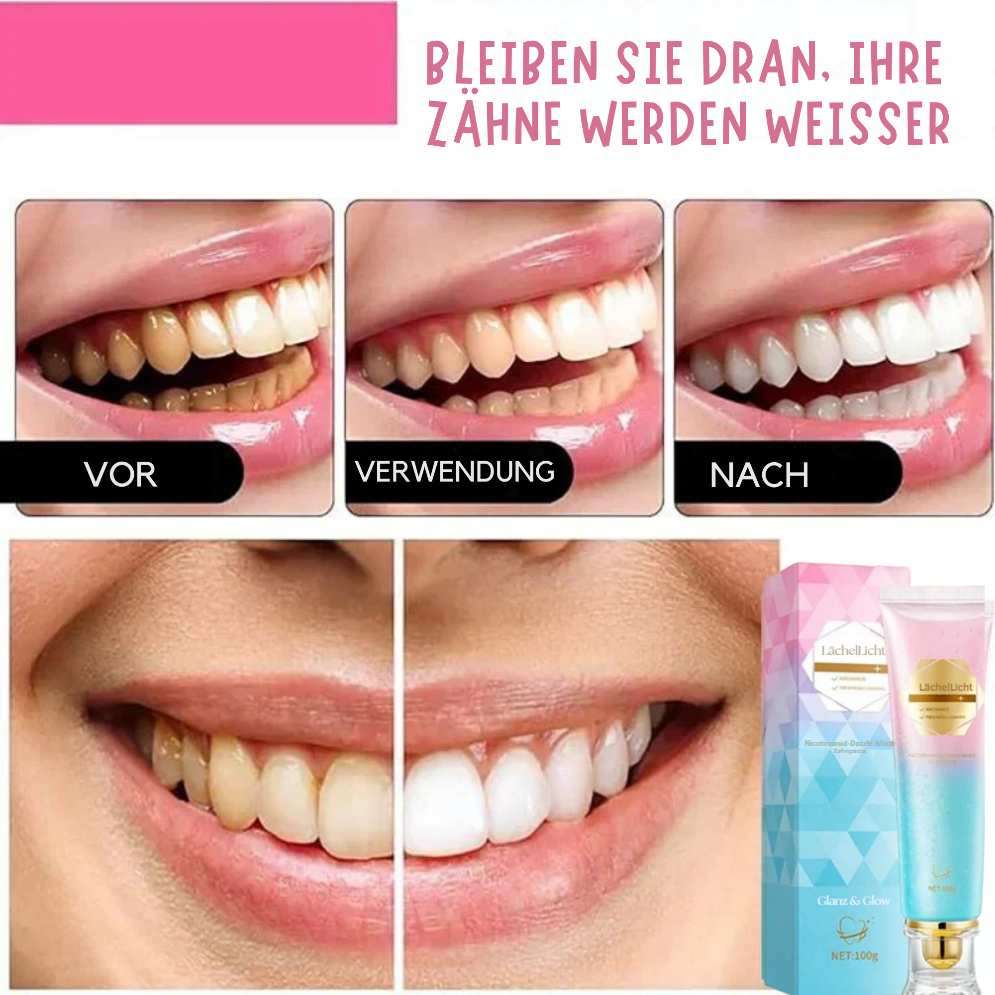 LächelLicht™ / Entfernt Hartnäckige Flecken