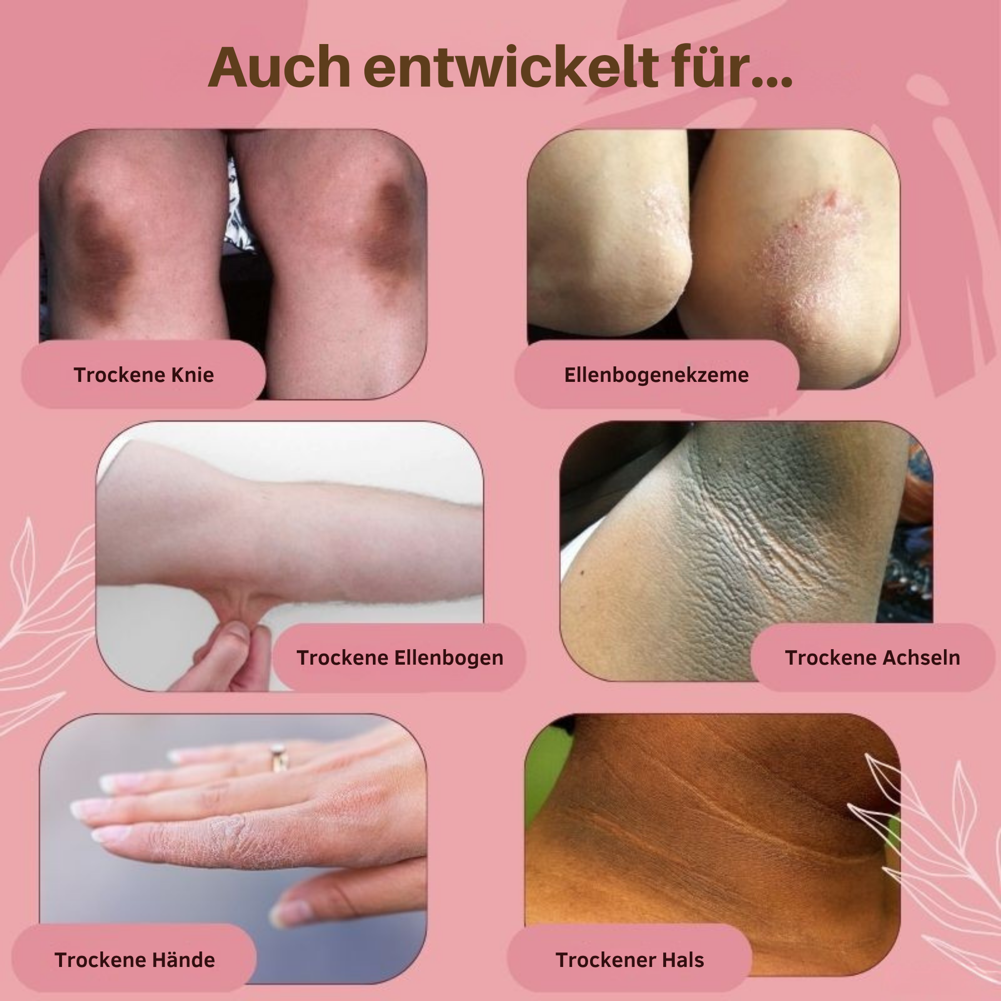 1+1 GRATIS | Milena - Fußerneuernde Pflegesalbe gegen Trockenheit, Geruch & Ekzeme