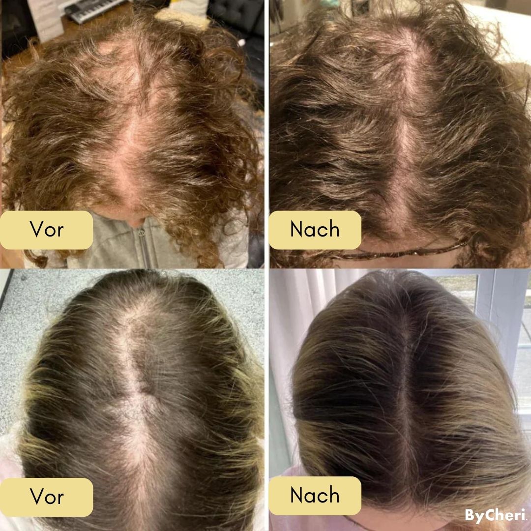 Katharina™ |  Ihre natürliche Ölbehandlung für Haarwachstum