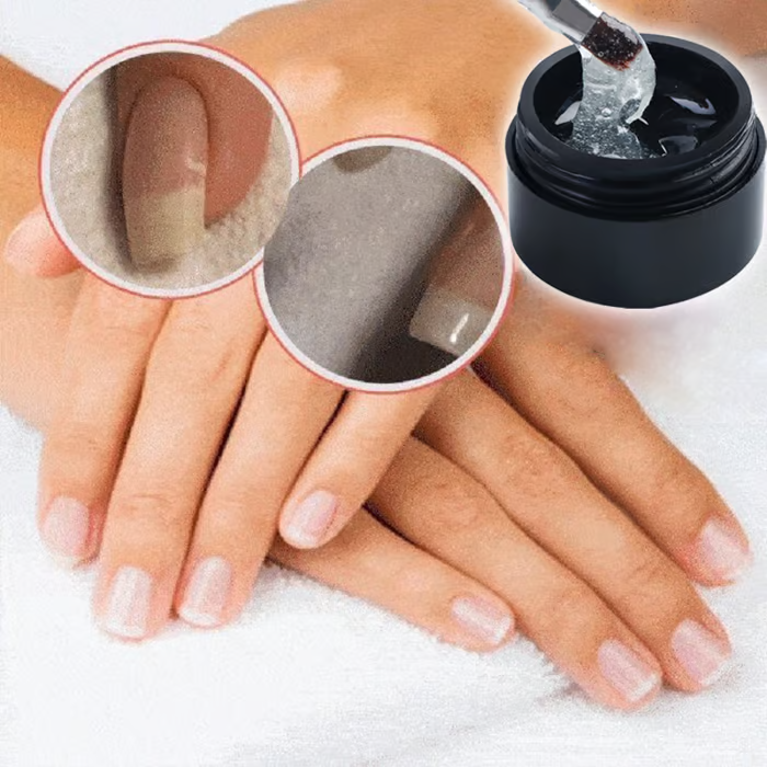 NagelNest™ / Reparierendes Und Schützendes Nagelgel (2+1 GRATIS)