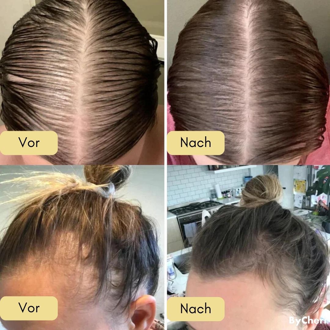 Katharina™ |  Ihre natürliche Ölbehandlung für Haarwachstum