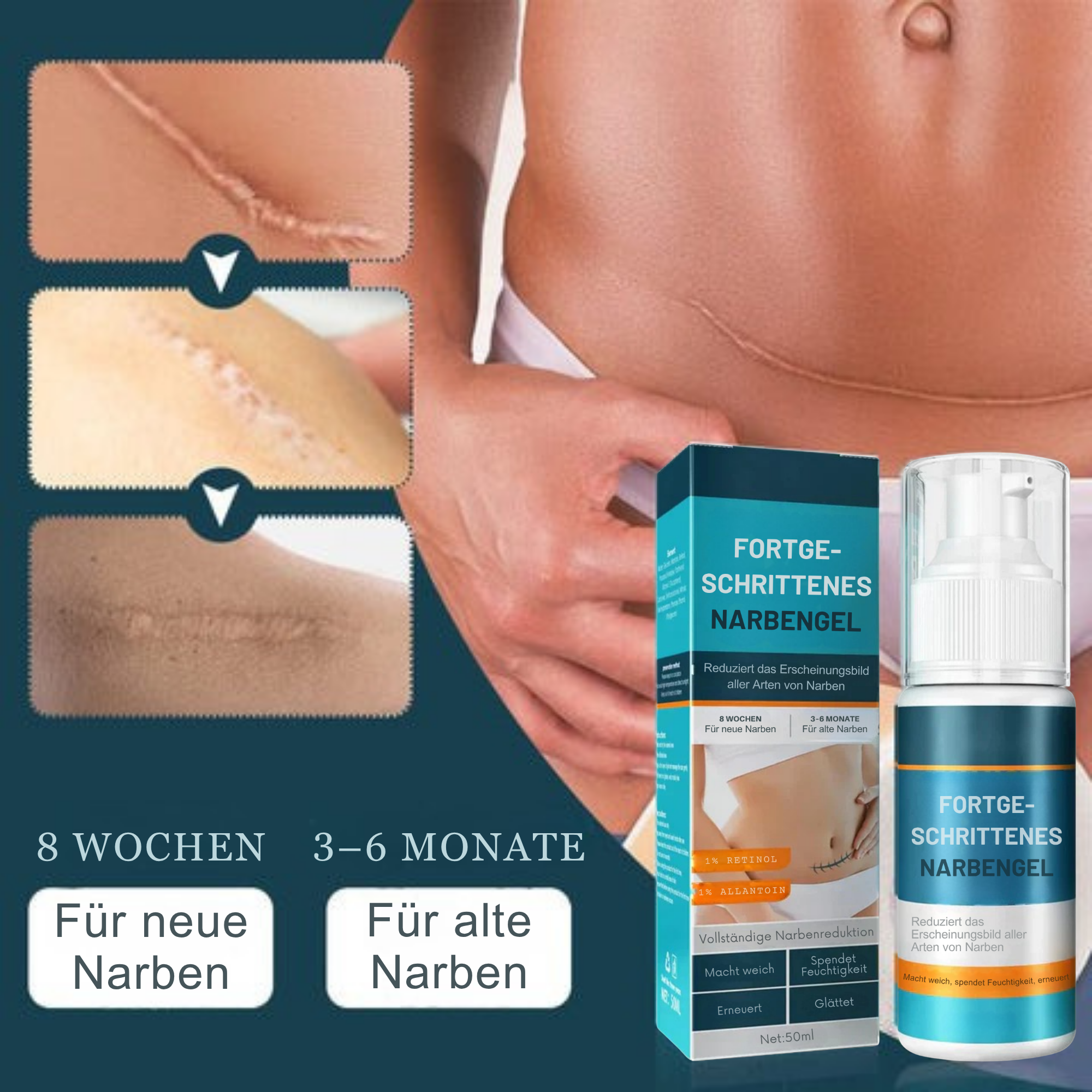 1+1 GRATIS | Littekengel Leonie zur sichtbaren Narbenmilderung