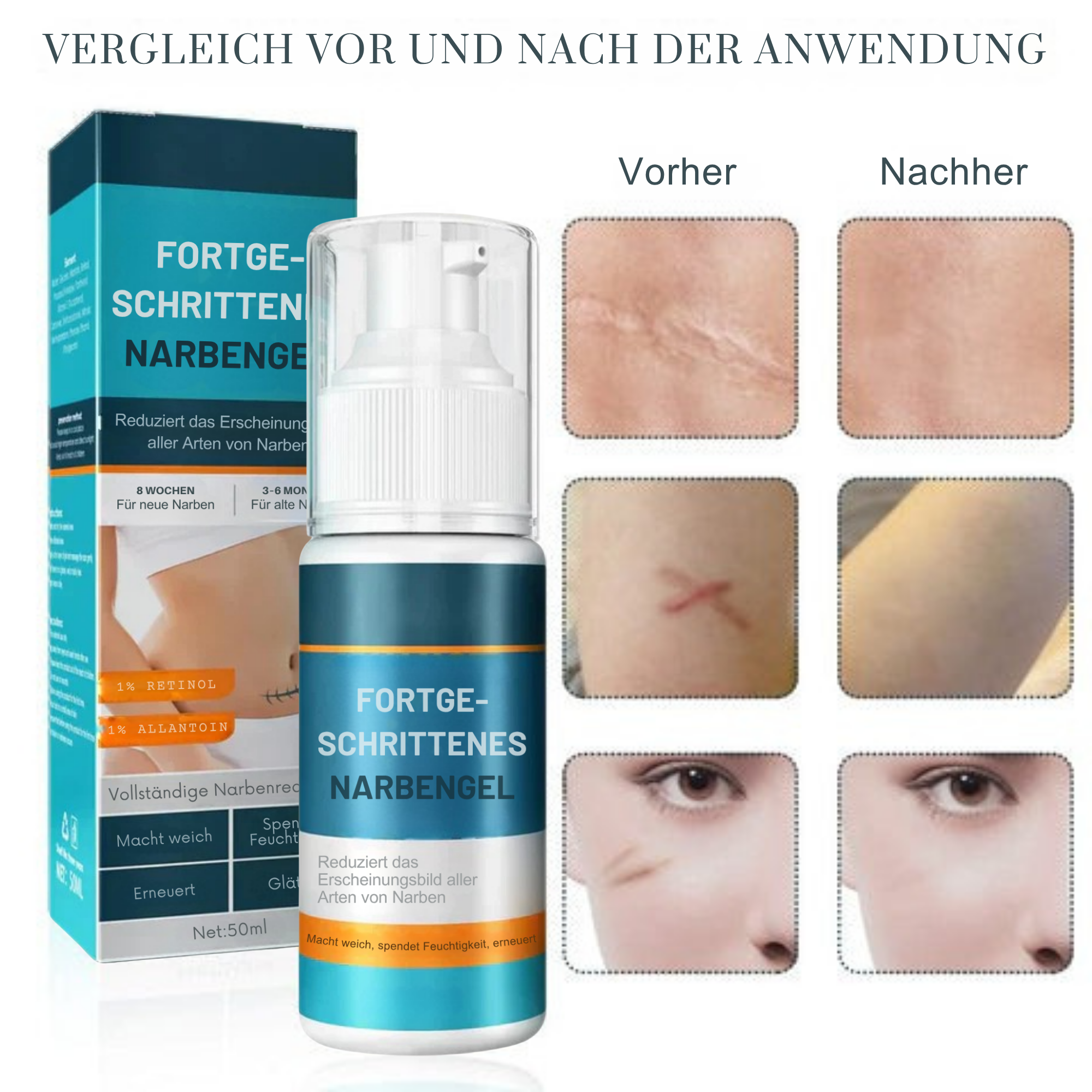 1+1 GRATIS | Littekengel Leonie zur sichtbaren Narbenmilderung