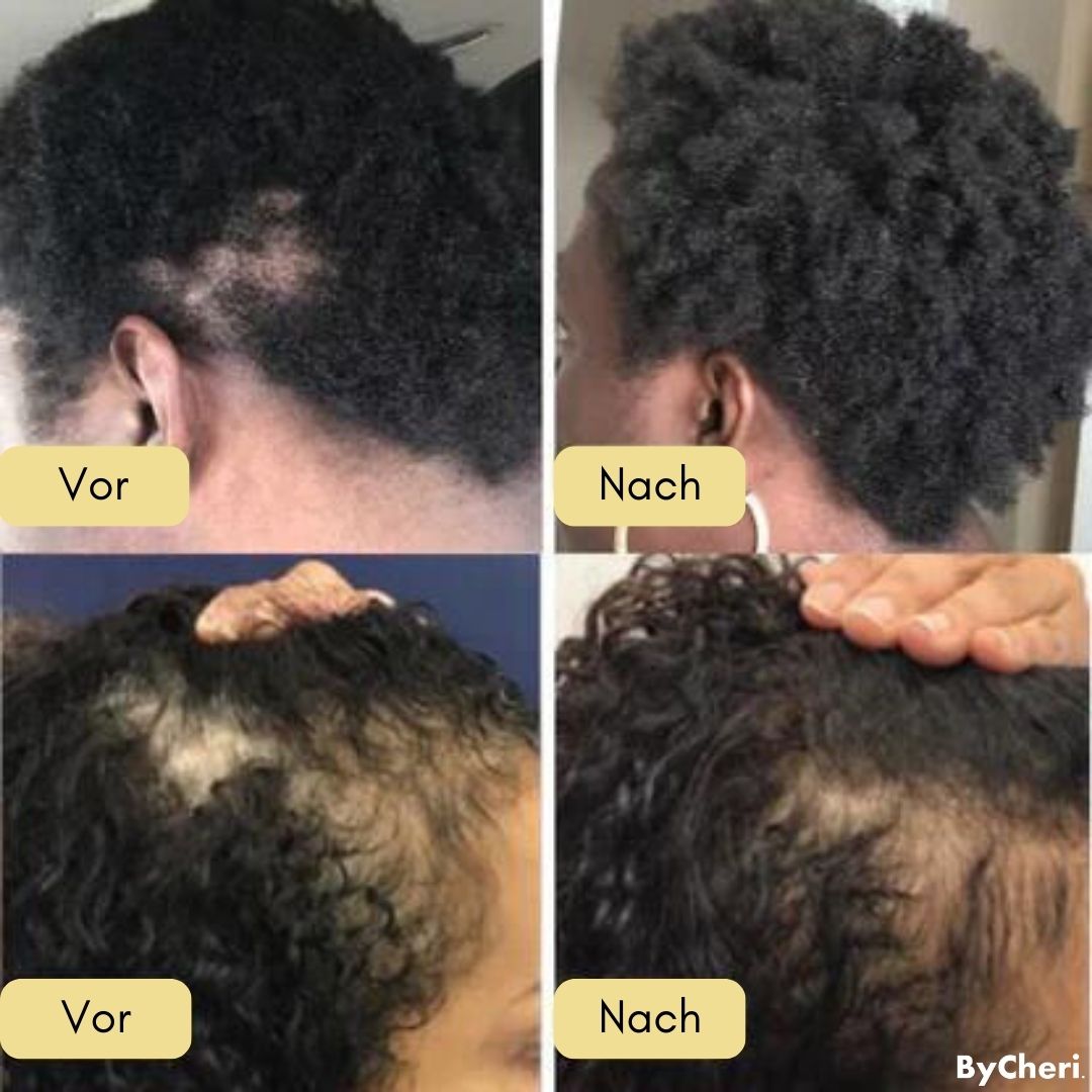 Katharina™ |  Ihre natürliche Ölbehandlung für Haarwachstum