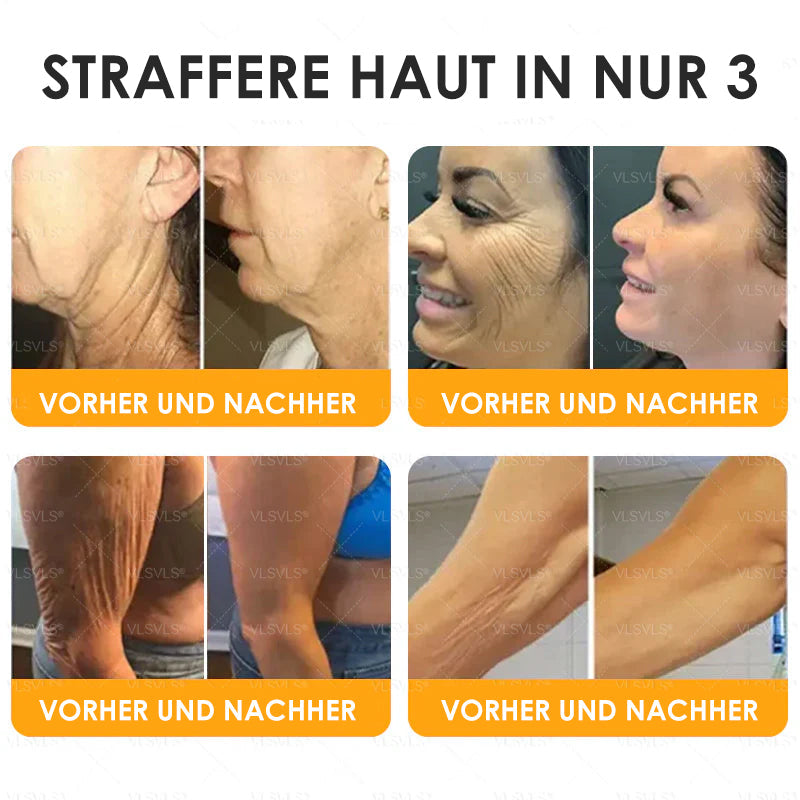 BienenBoost™ / Straffende Anti-Aging Creme Mit Bienengift Peptiden (1+1 GRATIS)