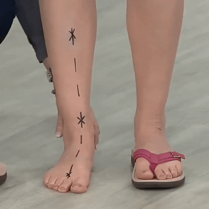 Pylera™ | Orthopädische Sommersandalen