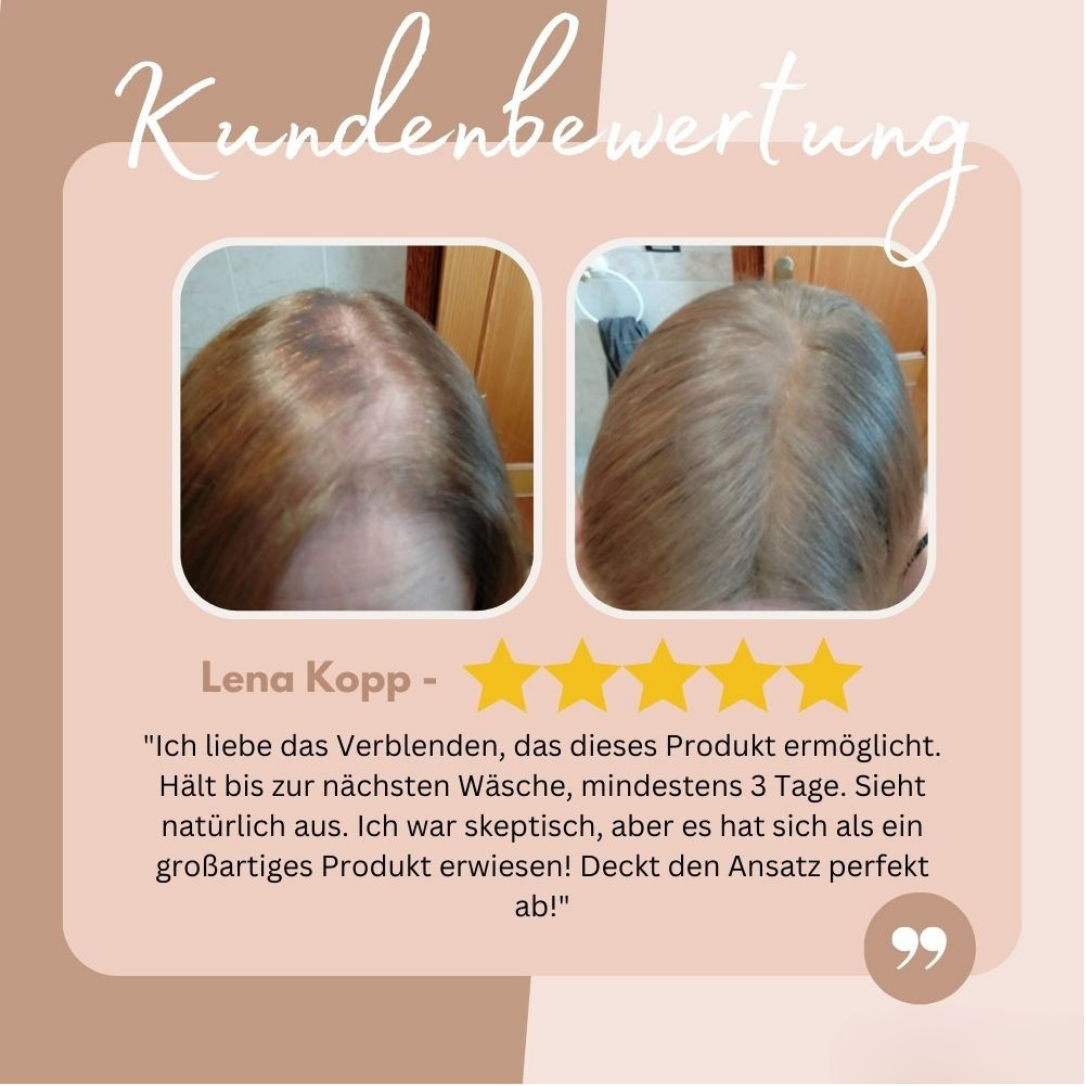 AnsatzAde™ / Sag Lebewohl zu Deinem Haaransatz! (1+1 GRATIS)