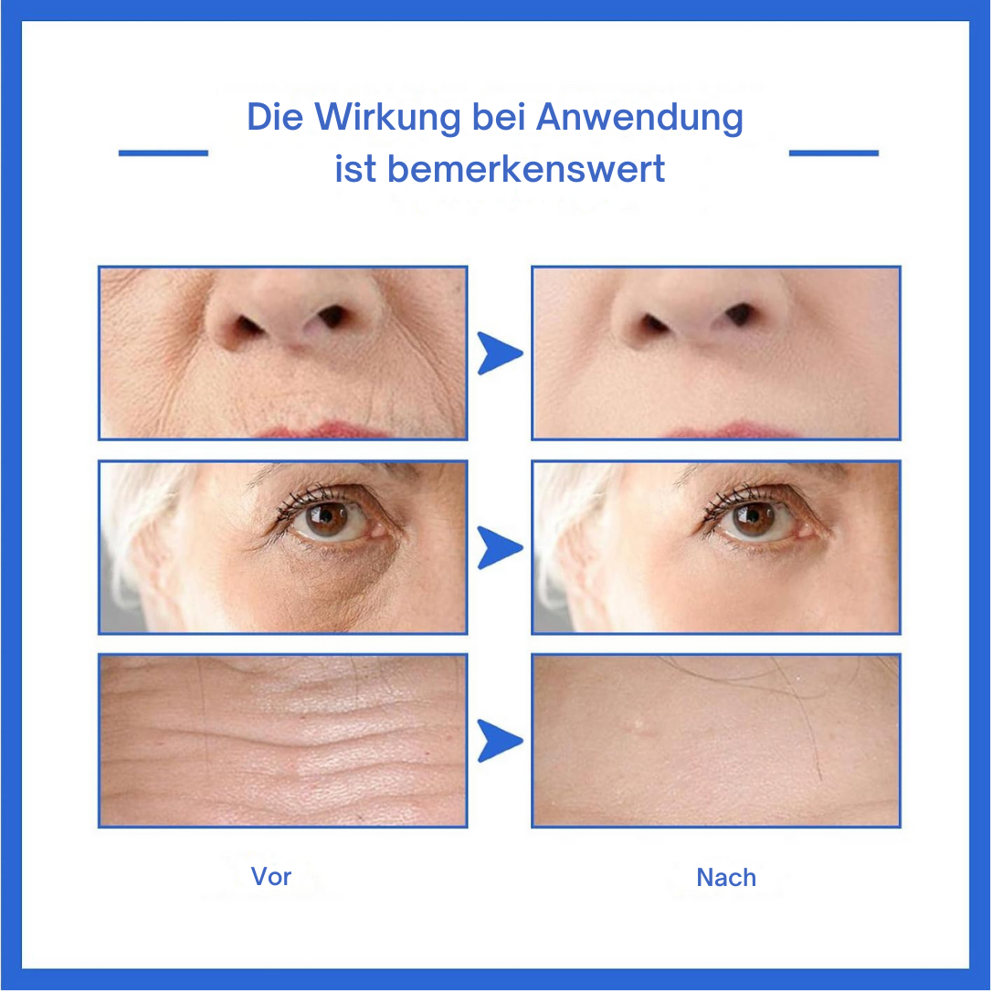 HautHoffnung™ / Für Ein Jüngeres Aussehen Ohne Operation (1+1 GRATIS)