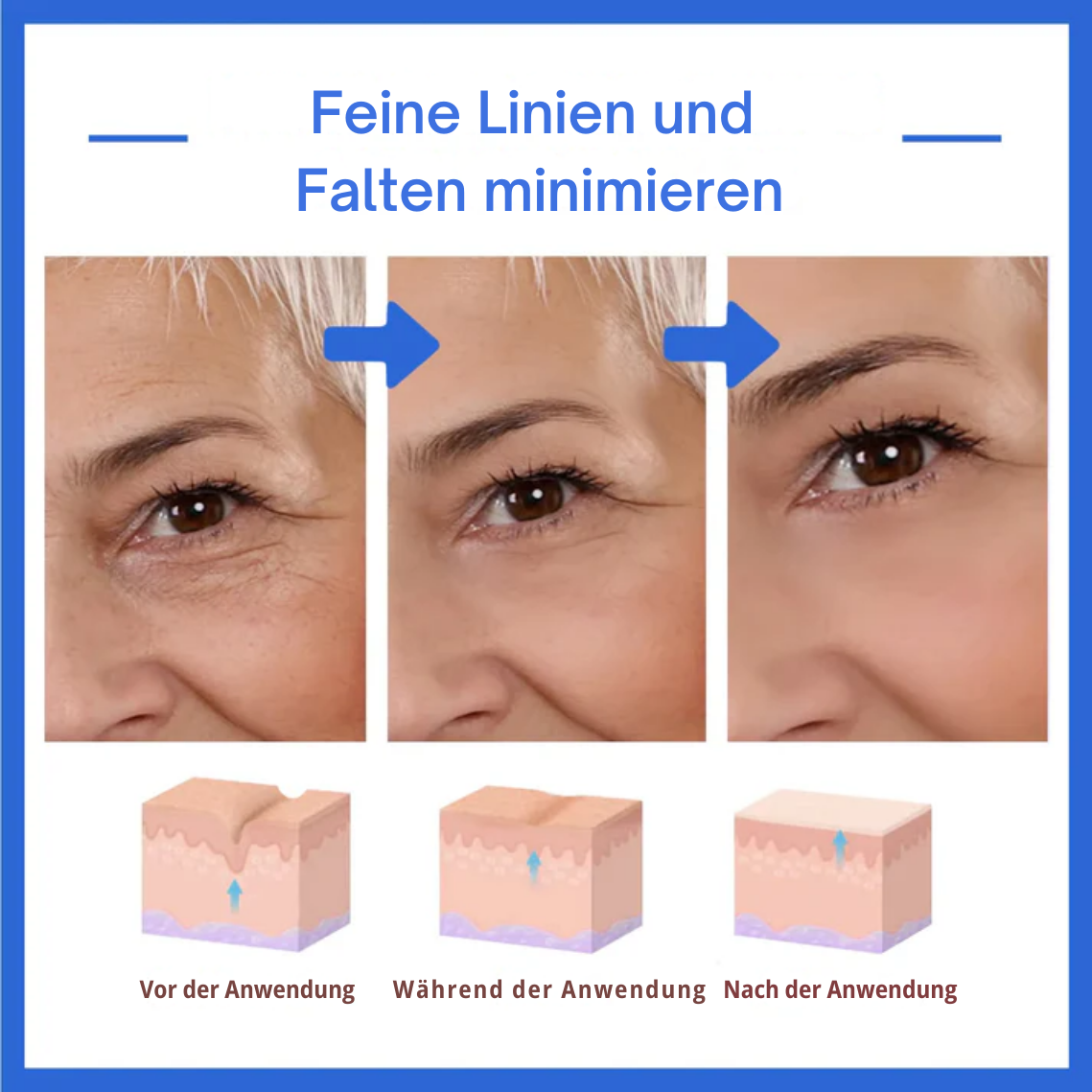 HautHoffnung™ / Für Ein Jüngeres Aussehen Ohne Operation (1+1 GRATIS)