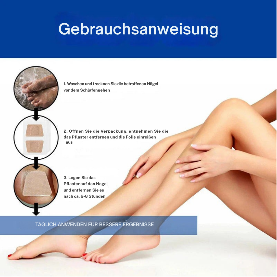 NagelNeuer / Wirksame Behandlung Von Nagelpilz (1+1 GRATIS)