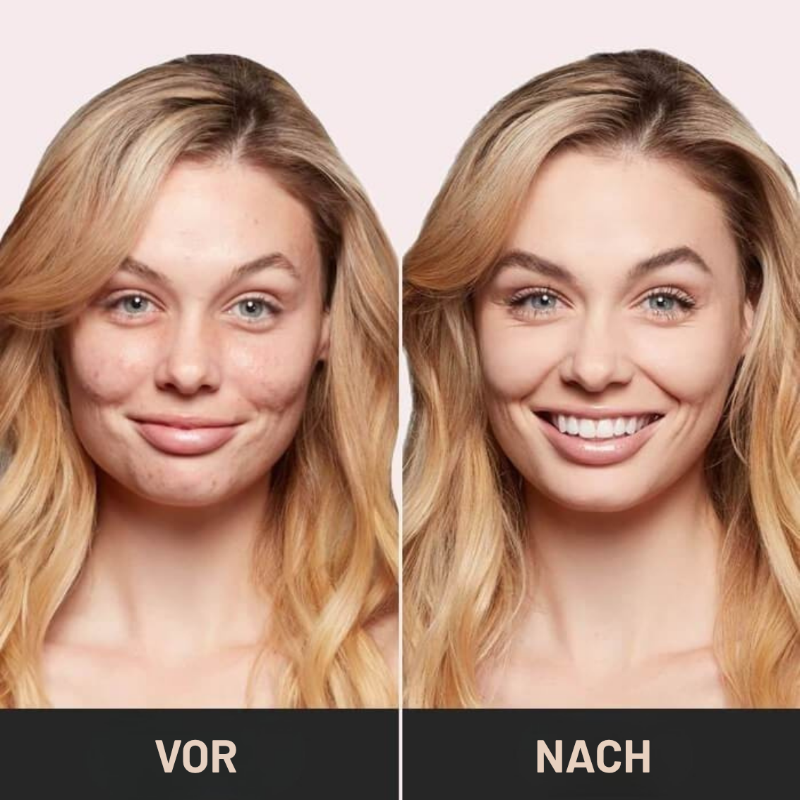 Emma™ – Jugendliches Aussehen