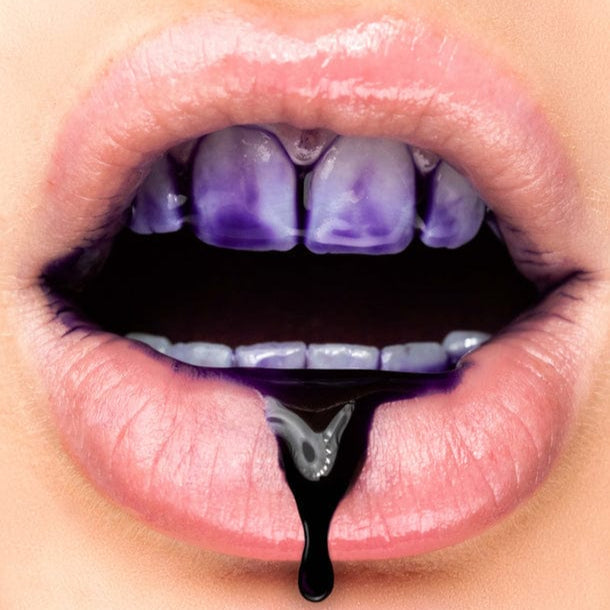 Whitening Gel – Für ein strahlendes Lächeln
