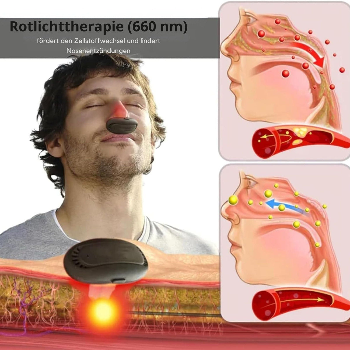 AtemAllen™ / Lindere Nasendruck Und Atme Tief Durch! - Sopheria
