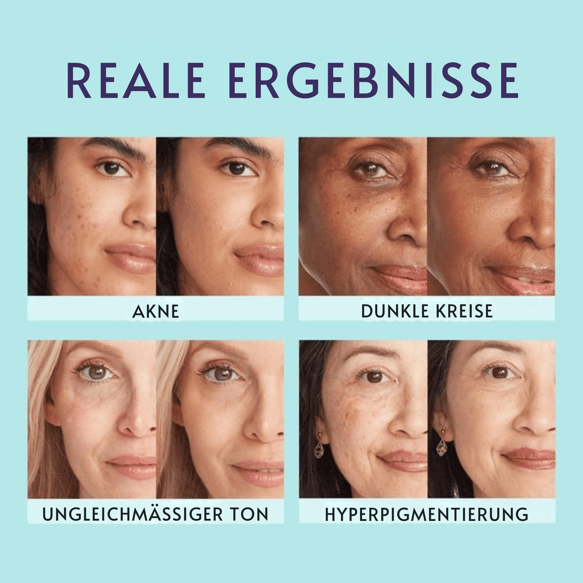 CremeKlar™ / Feuchtigkeitsspendender Concealer mit natürlichem Deckkraft-Finish - Sopheria