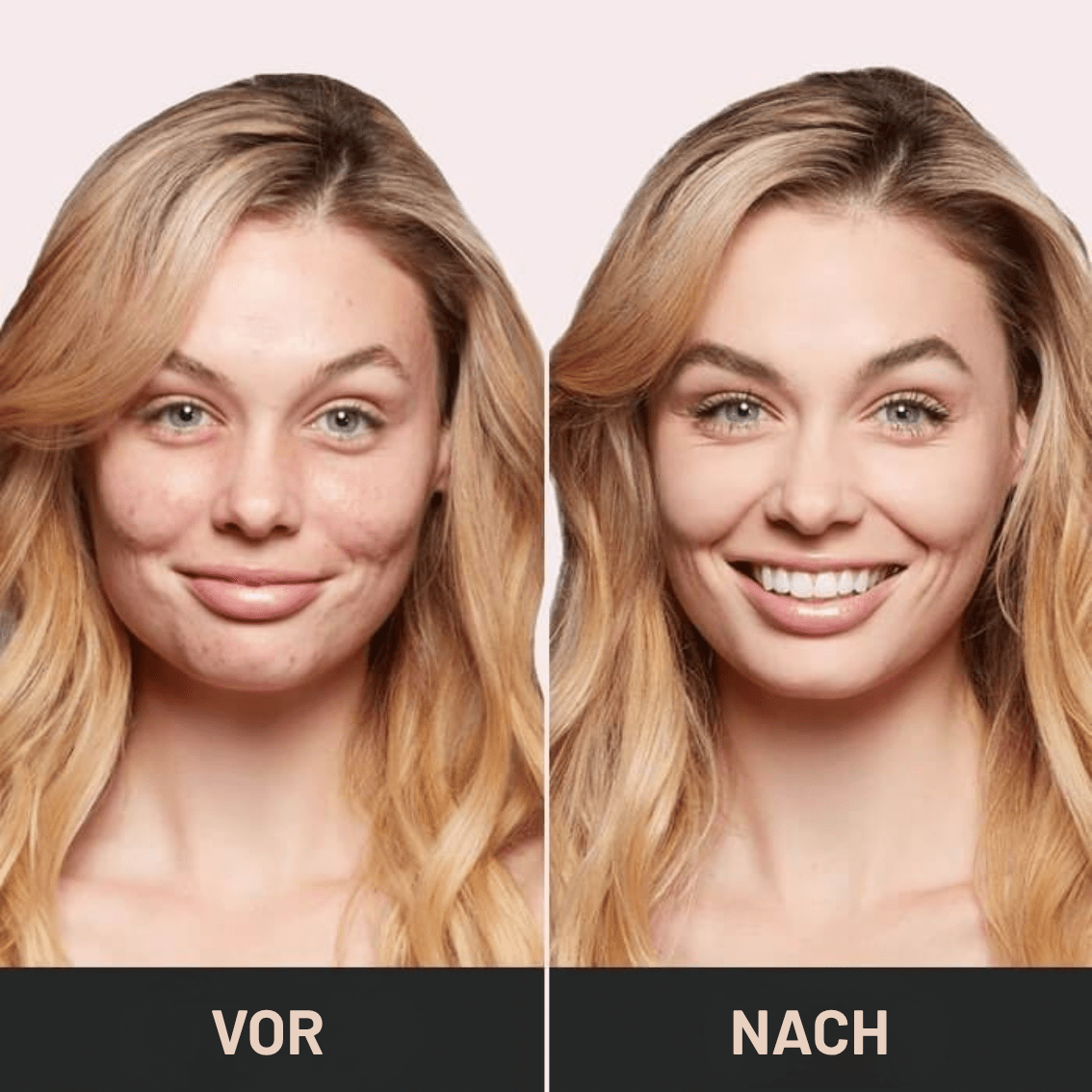 Emma™ – Jugendliches Aussehen - Sopheria