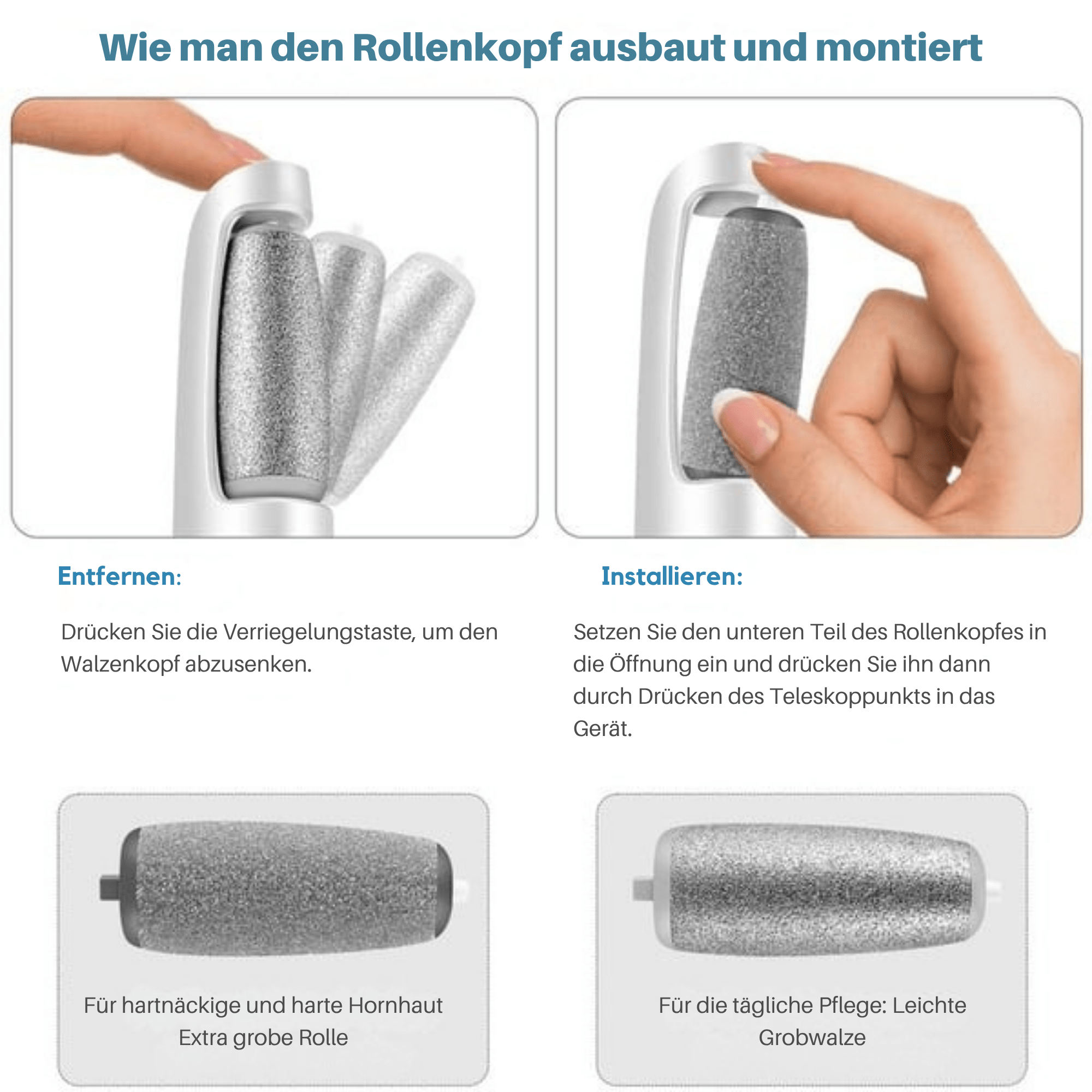 FeenFuß™ / Elektrischer Hornhautentferner - Sopheria