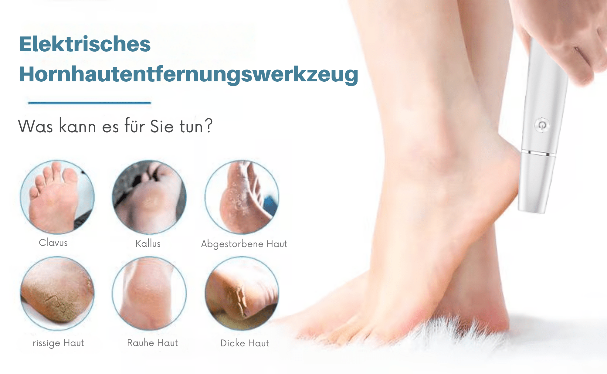 FeenFuß™ / Elektrischer Hornhautentferner - Sopheria