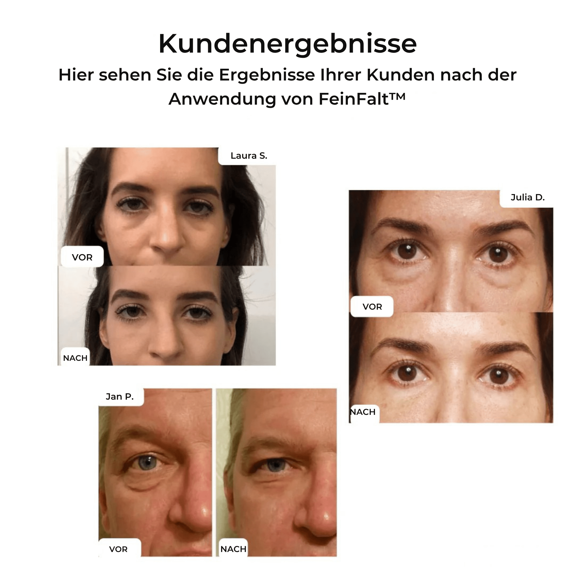 FeinFalt™ / Augenstraffende Creme (1+1 GRATIS) - Sopheria