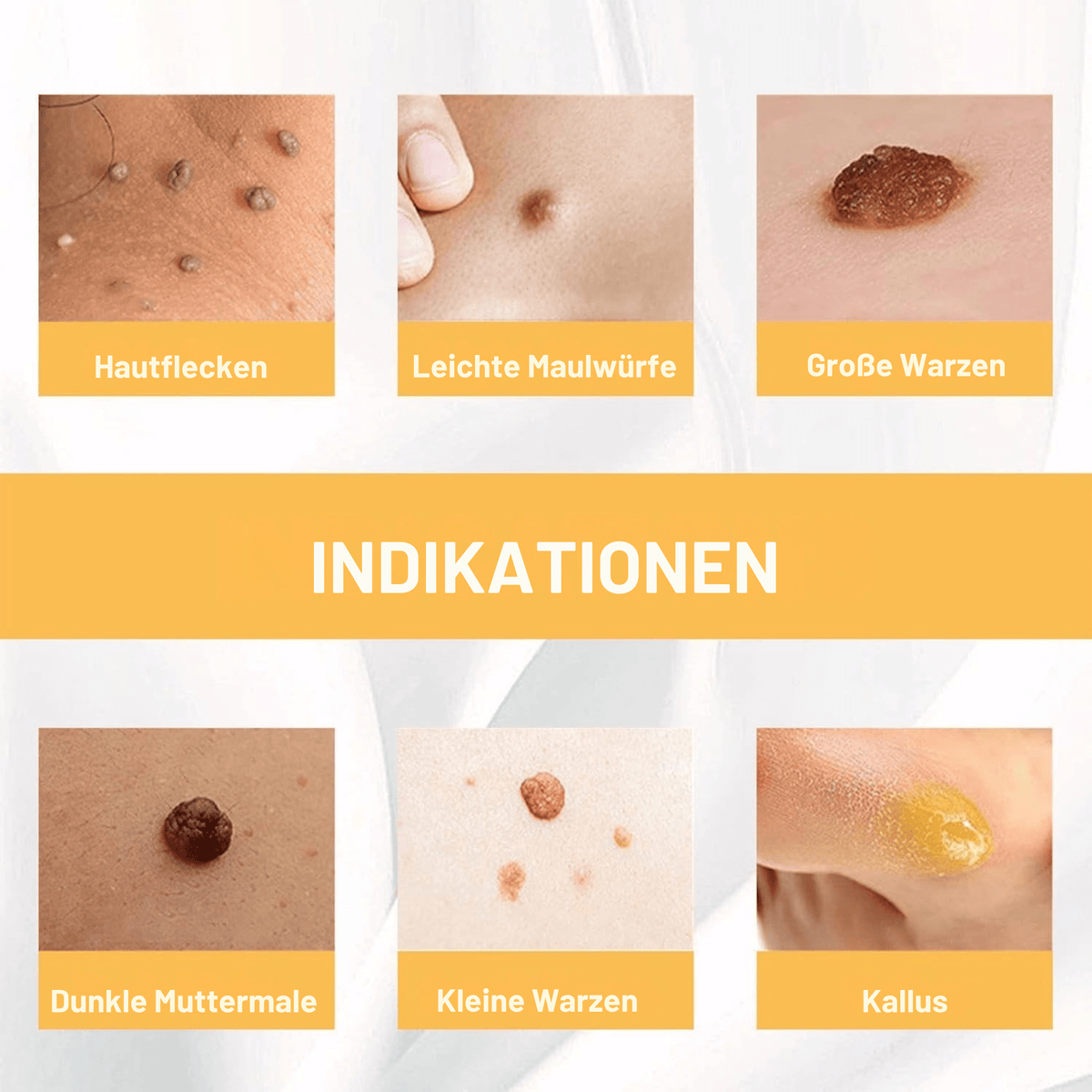 FleckFrei™ / Erhalte Makellose, Fleckenfreie Haut! (1+1 GRATIS) - Sopheria