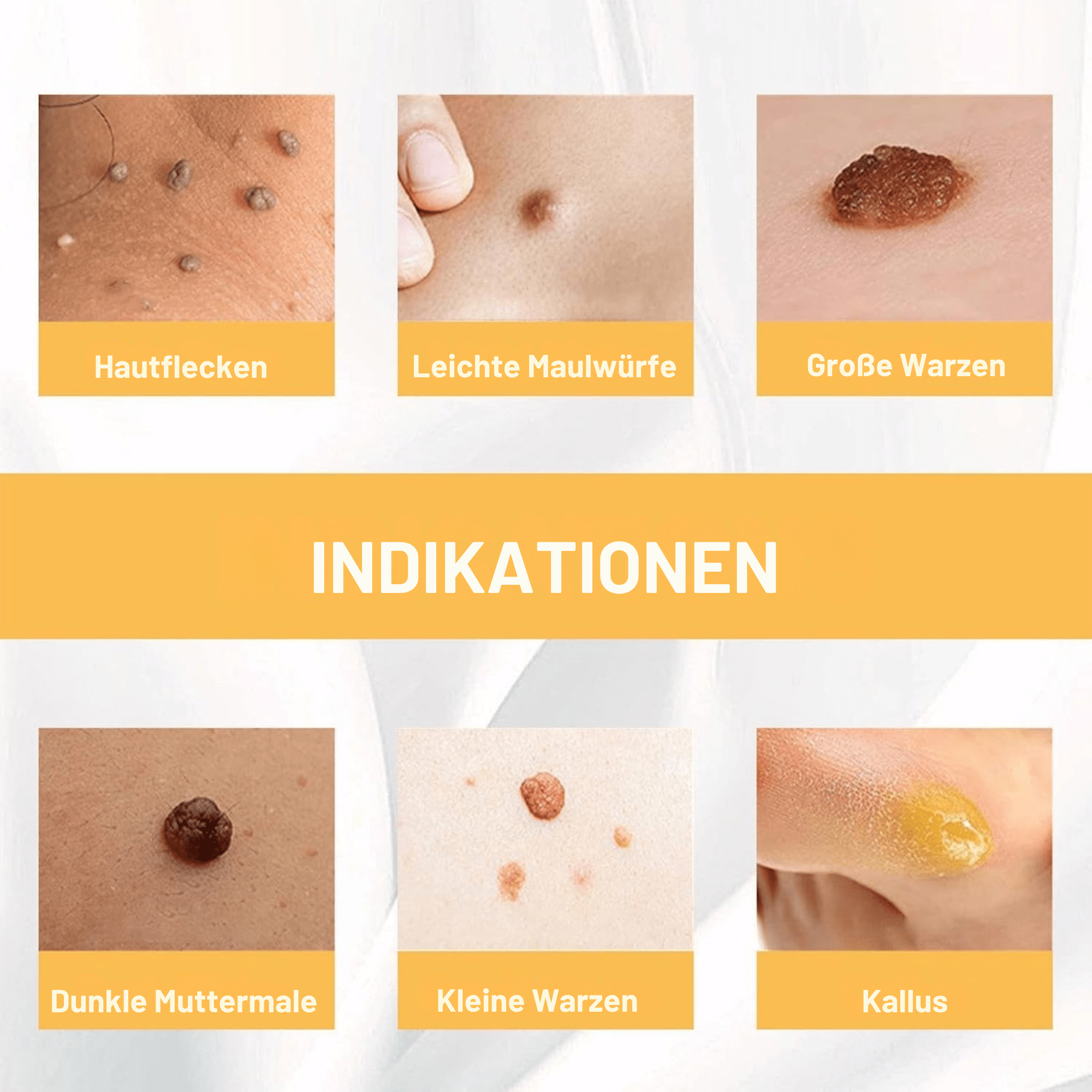 FleckFrei™ / Erhalte Makellose, Fleckenfreie Haut! (1+1 GRATIS) - Sopheria