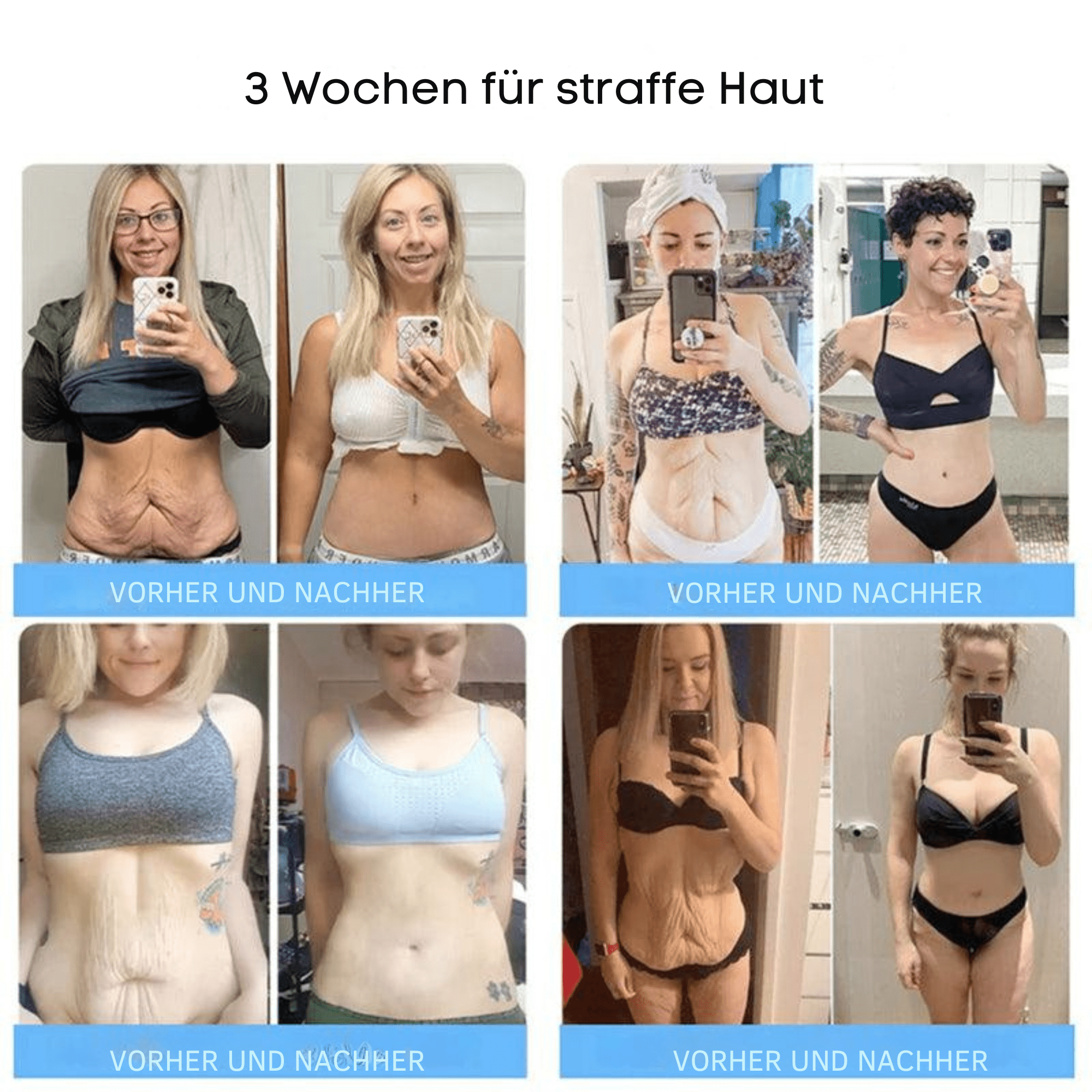 FormFrische™ / Glättet und strafft Ihre Haut auf natürliche Weise - Sopheria