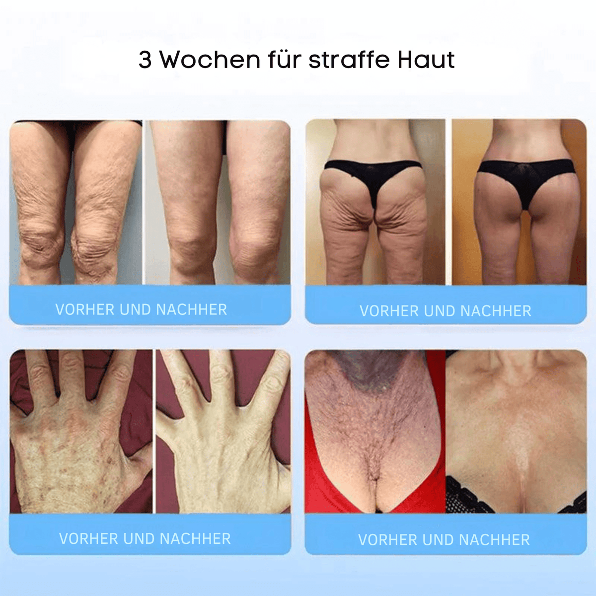 FormFrische™ / Glättet und strafft Ihre Haut auf natürliche Weise - Sopheria