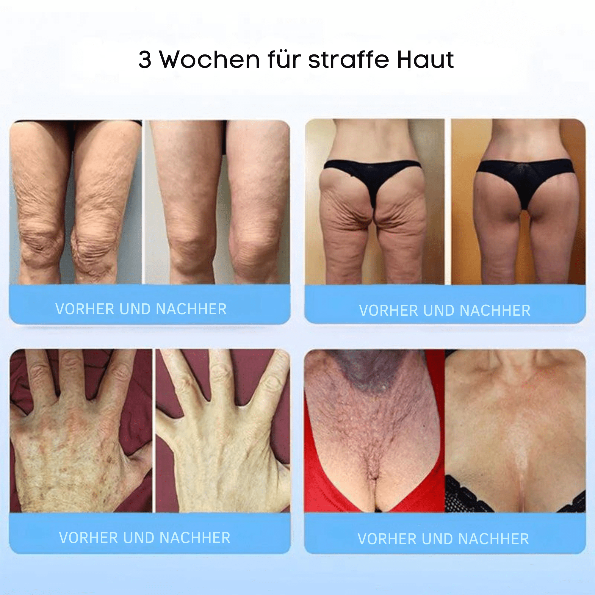 FormFrische™ / Glättet und strafft Ihre Haut auf natürliche Weise - Sopheria