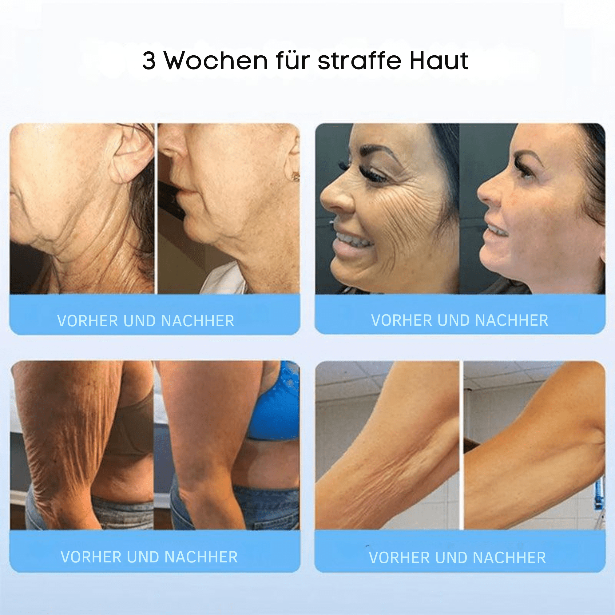FormFrische™ / Glättet und strafft Ihre Haut auf natürliche Weise - Sopheria