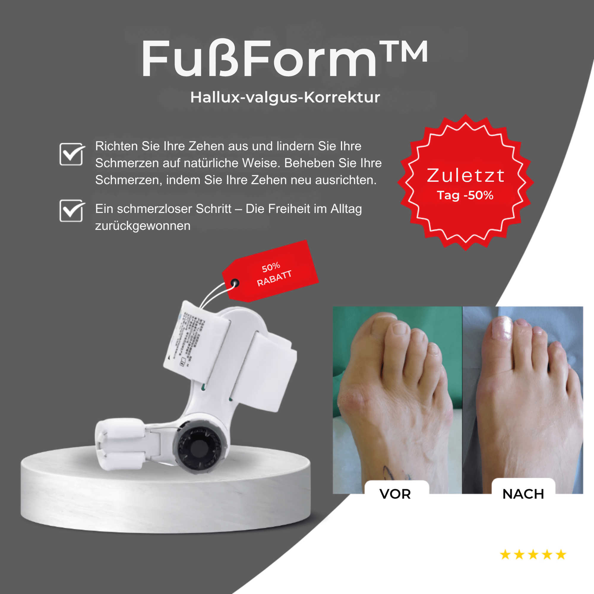 FußForm™ / Hallux Valgus Korrektur - Sopheria