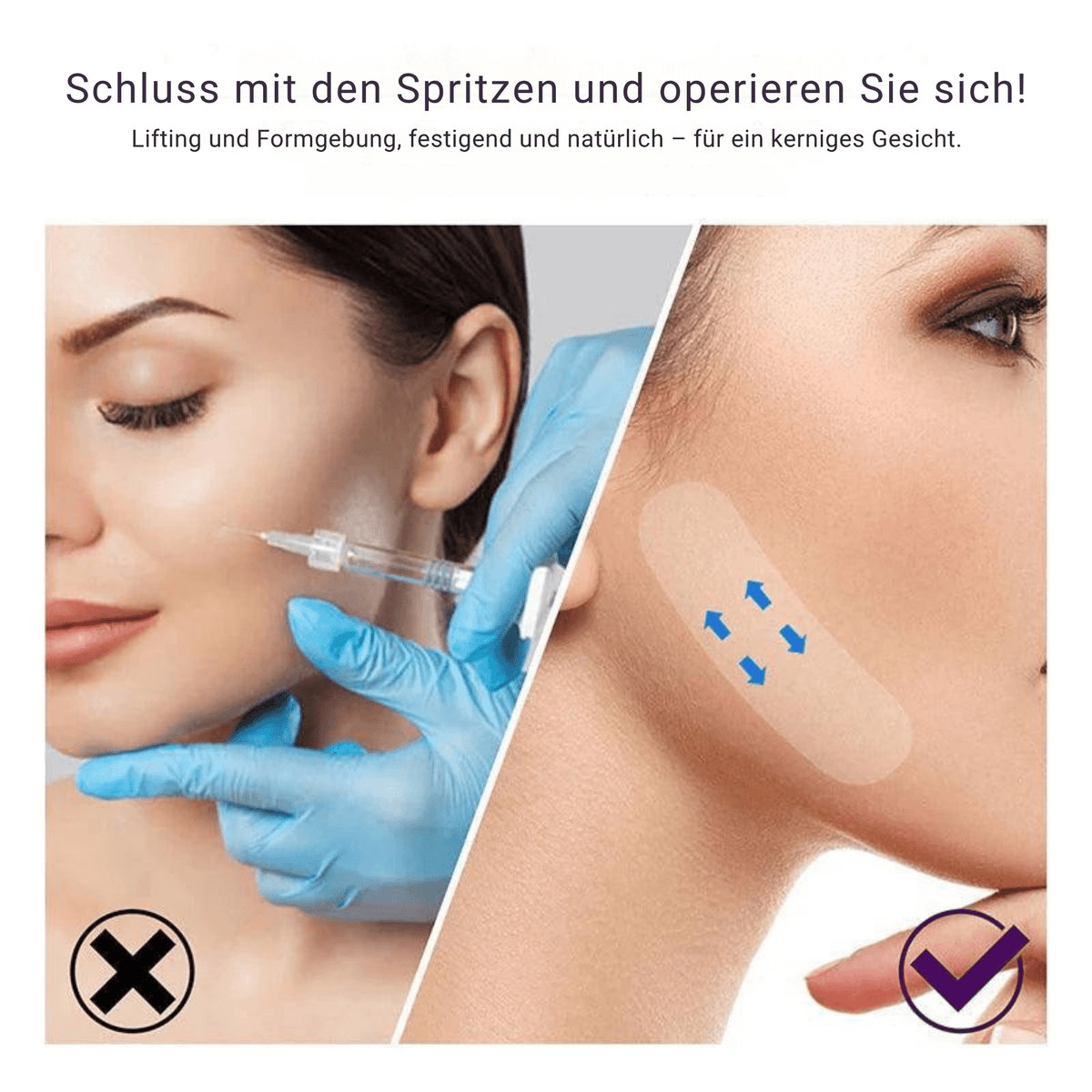 Gabriele – Sofortige Gesichtsstraffung - Sopheria