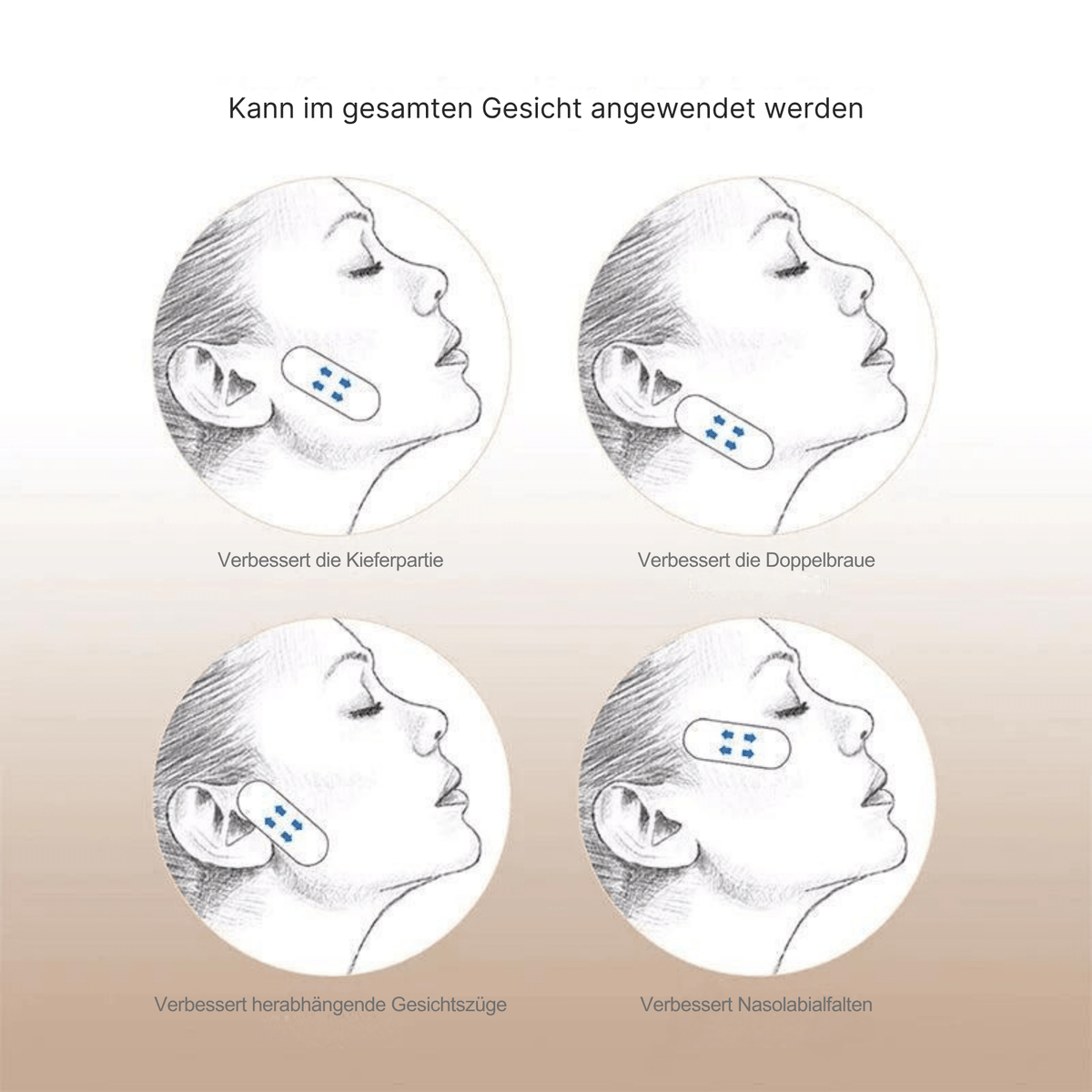 Gabriele – Sofortige Gesichtsstraffung - Sopheria
