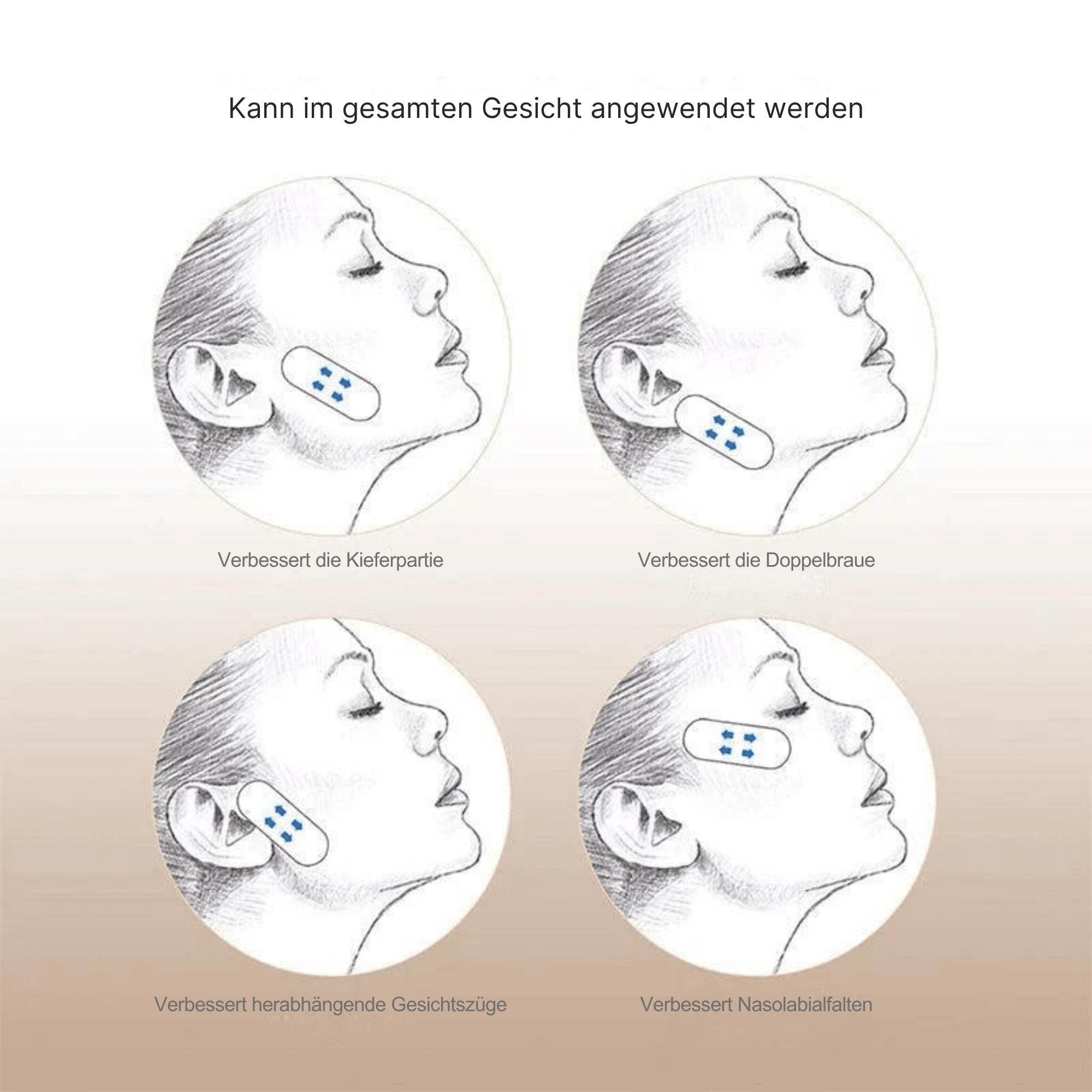 Gabriele – Sofortige Gesichtsstraffung - Sopheria