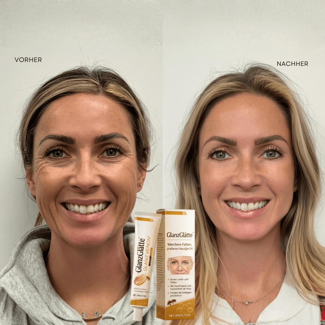 GlanzGlätte™ / Weichere Falten, pralleres Hautgefühl - Sopheria