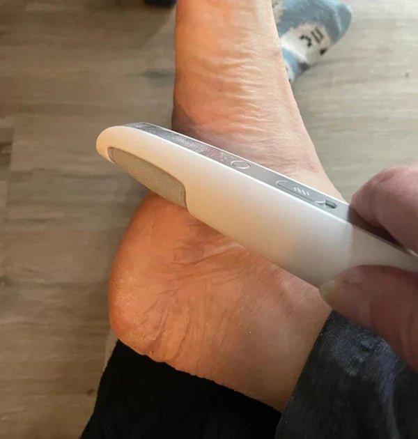 GlattGeh™ / Elektrischer Hornhautentferner - Sopheria
