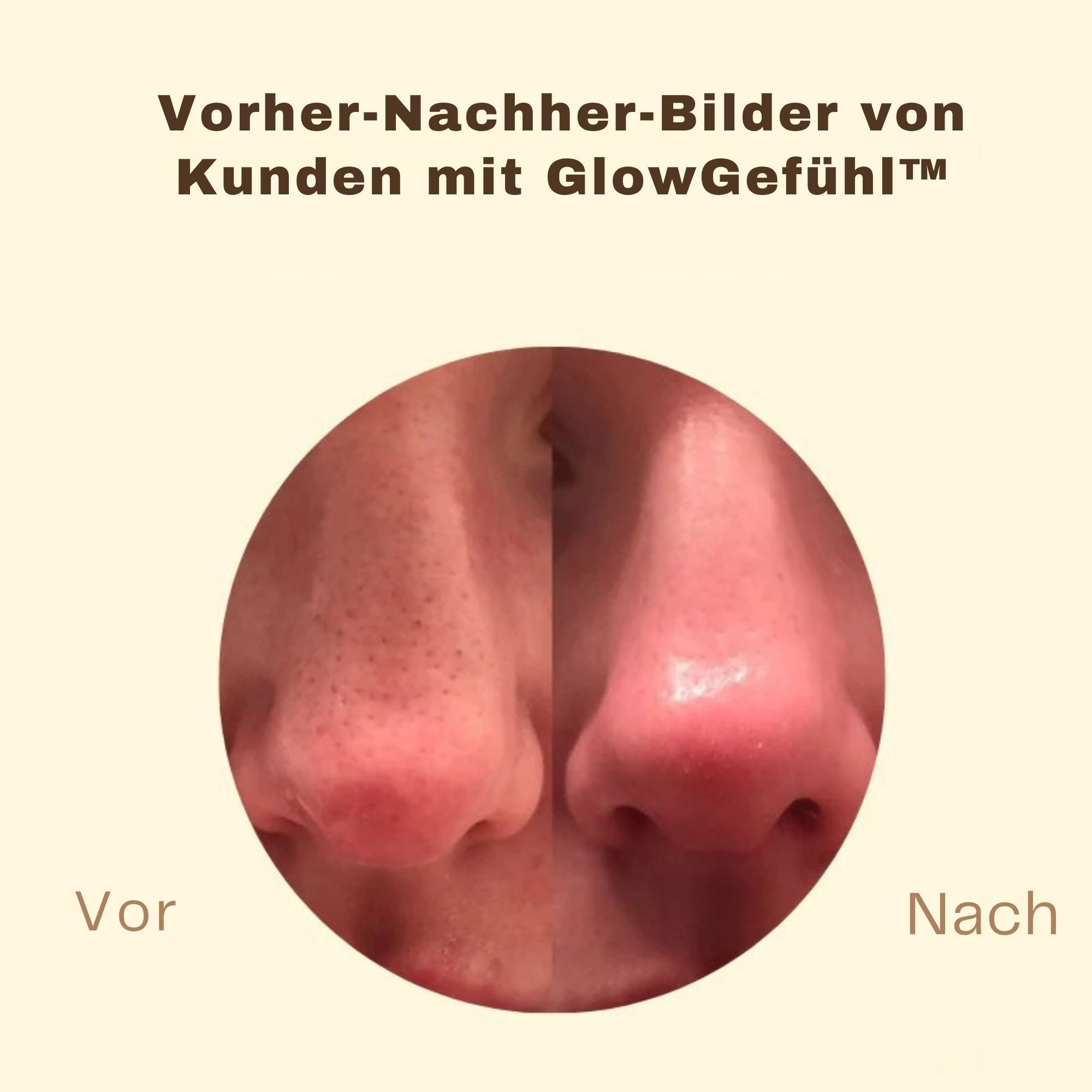 GlowGefühl™ / Schwarze Tee Maske Für Klare, Junge Haut (1+1 GRATIS) - Sopheria