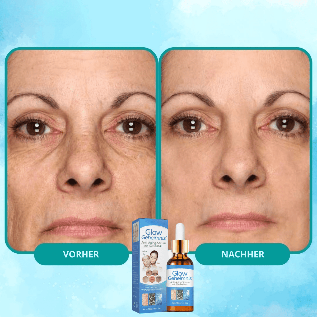 GlowGeheimnis™ / Anti-Aging-Serum mit Soforteffekt (1 + 1 GRATIS) - Sopheria