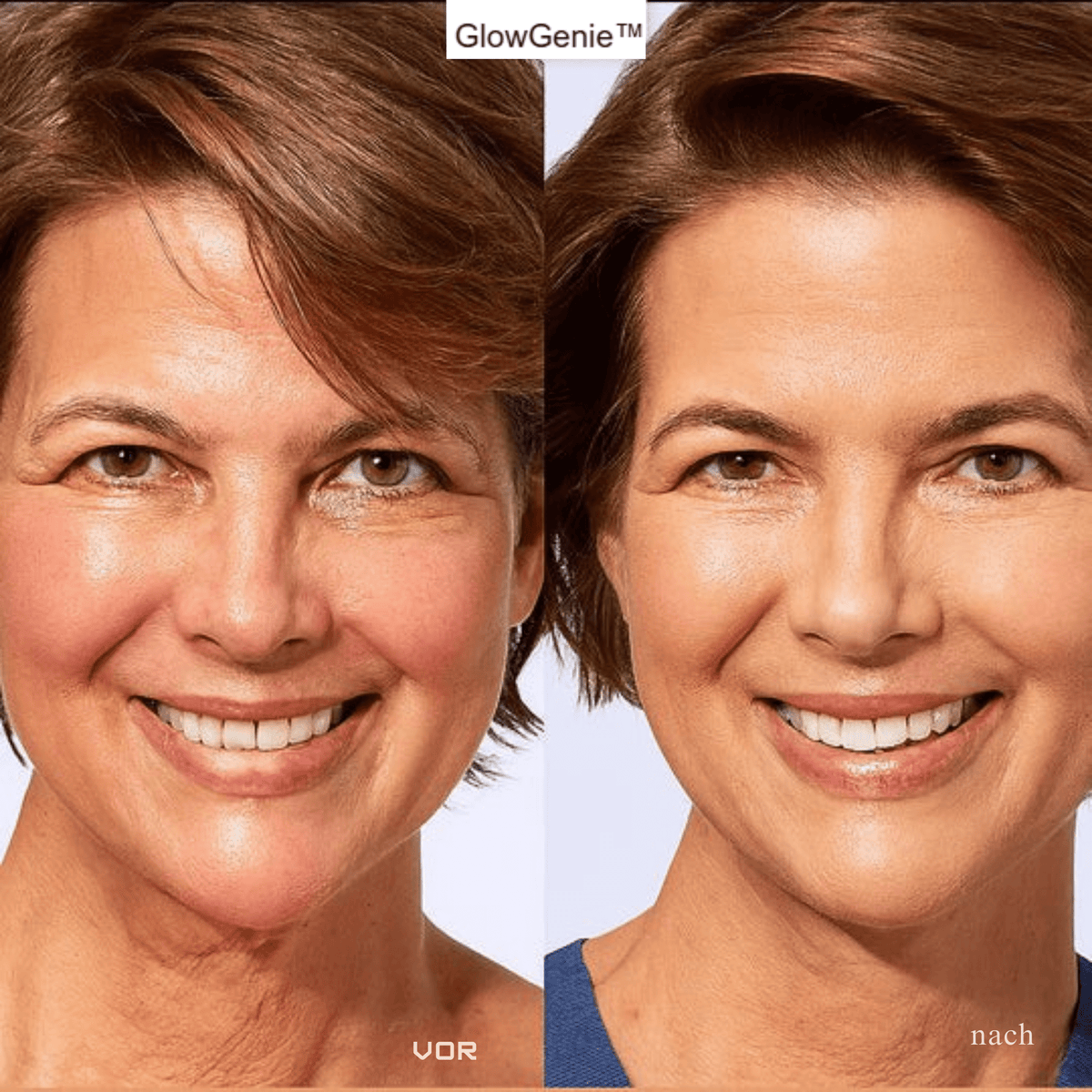 GlowGenie™ / Die Revolution für reife Haut – für strahlende Jugend (1+1 GRATIS) - Sopheria