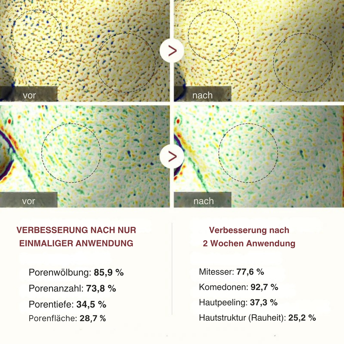 GlowGetreide™ / Reis-Peeling-Duo - Sopheria