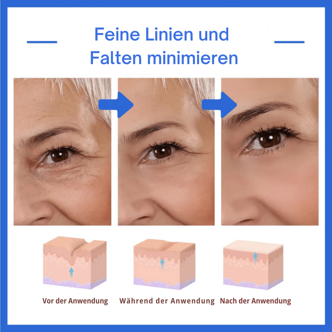 HautHoffnung™ / Für Ein Jüngeres Aussehen Ohne Operation (1+1 GRATIS) - Sopheria
