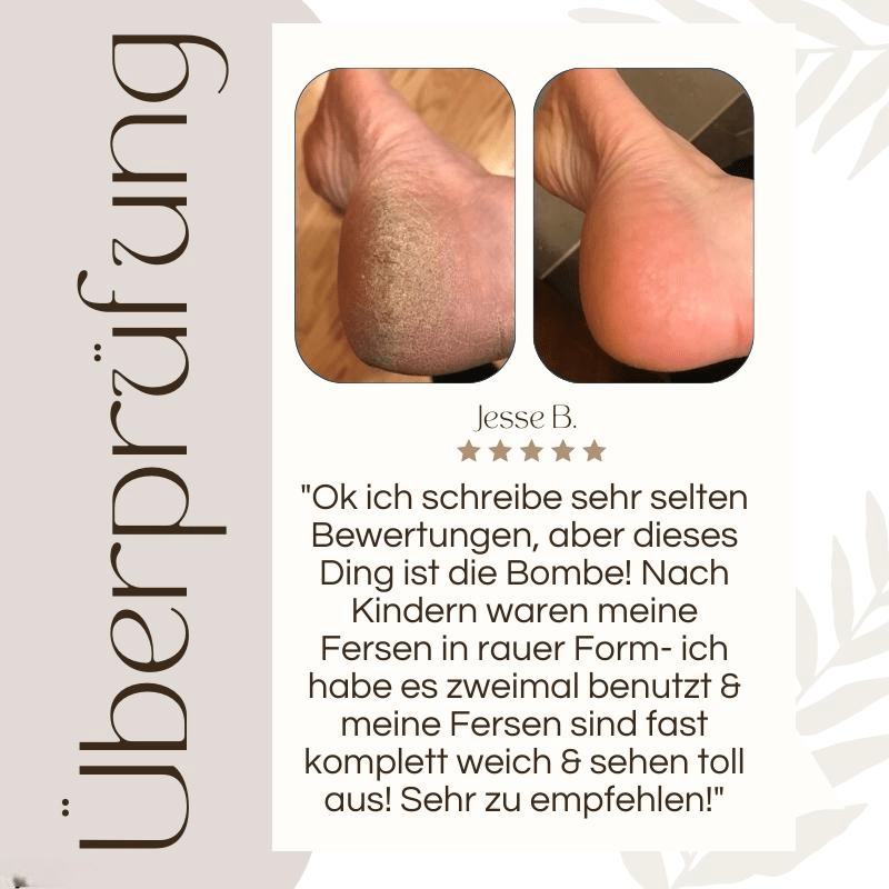 HornhautPro™ | Elektrischer Hornhautverwalter - Sopheria