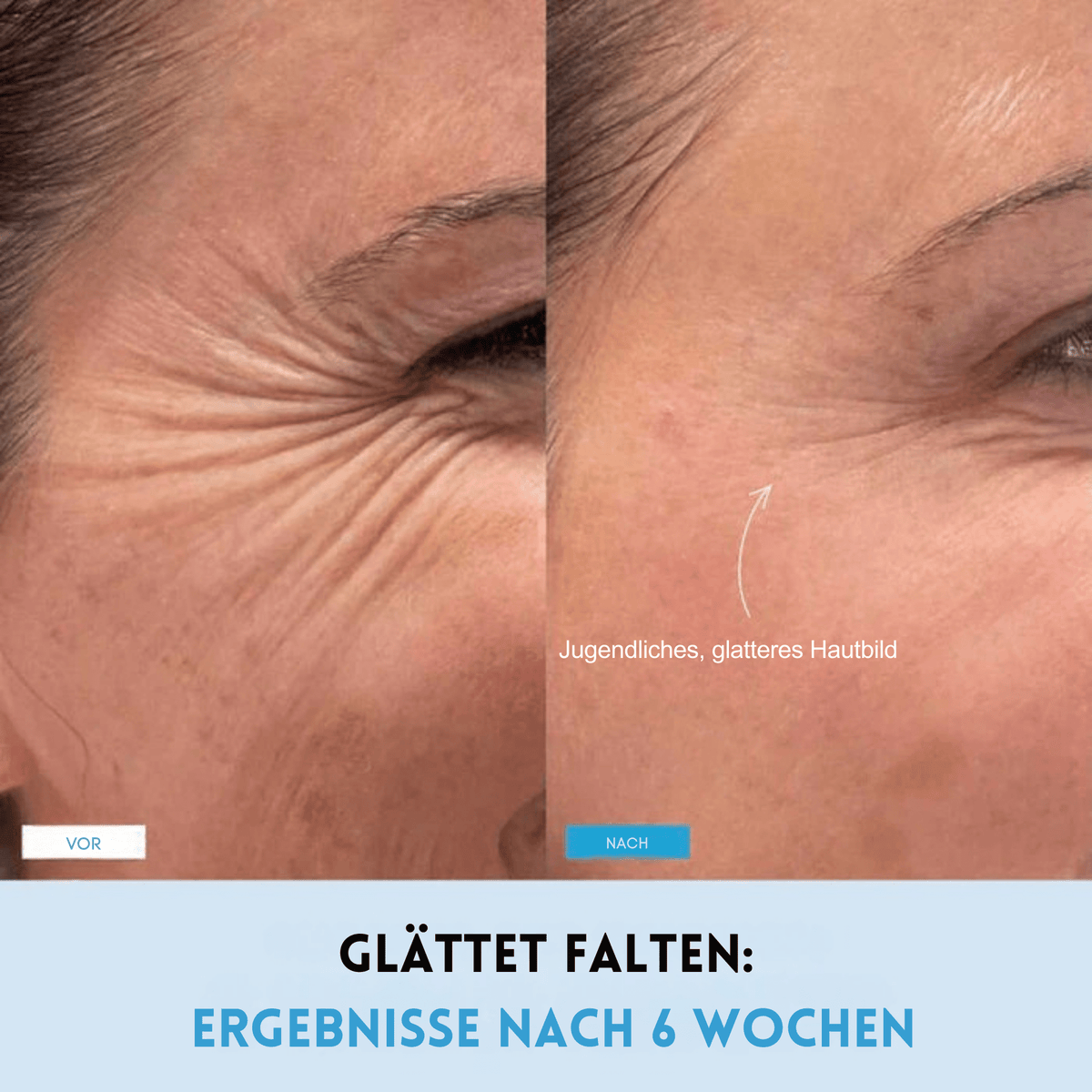KinnKontur™ / Für eine sichtbar definierte Kinnlinie in nur 5 Minuten täglich - Sopheria