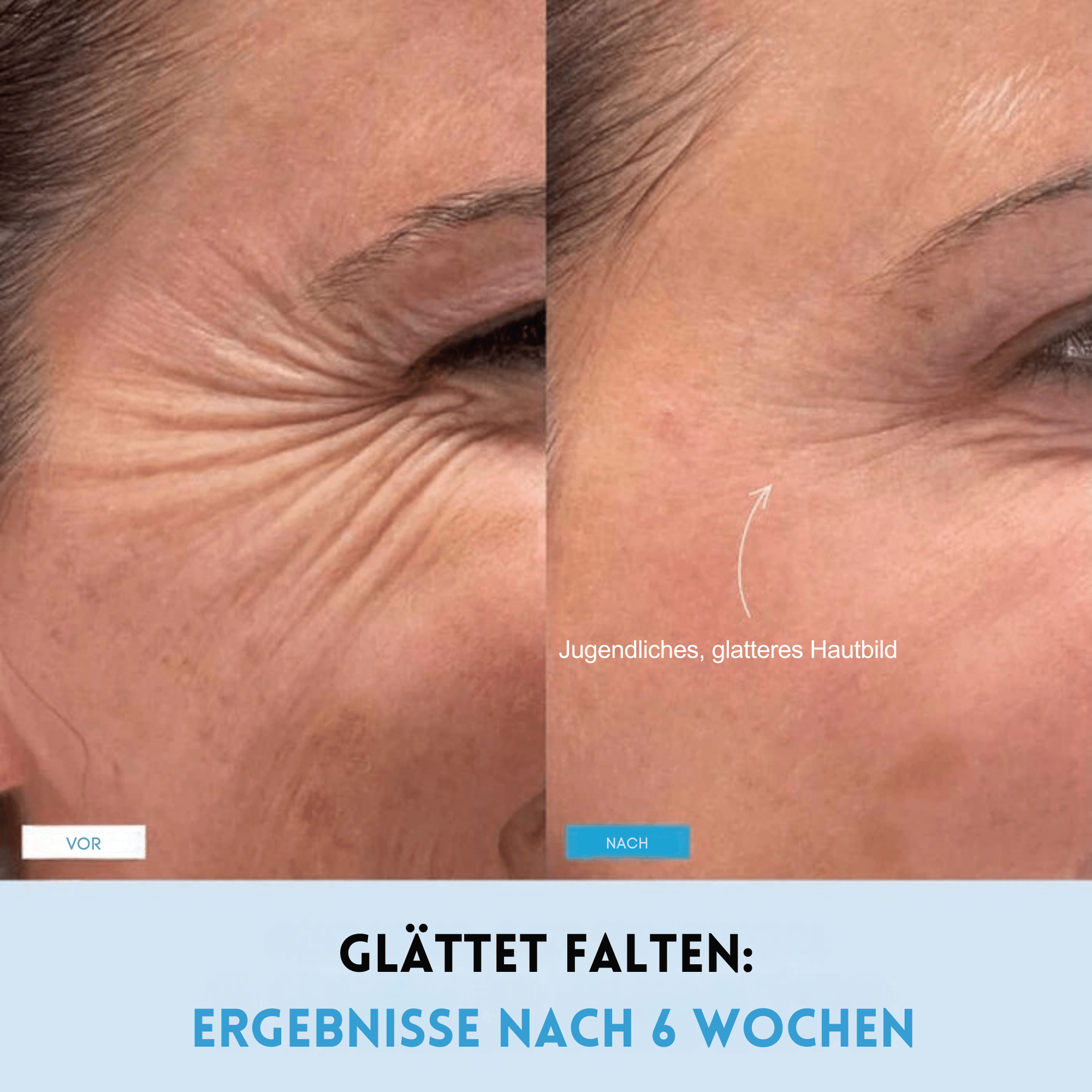 KinnKontur™ / Für eine sichtbar definierte Kinnlinie in nur 5 Minuten täglich - Sopheria