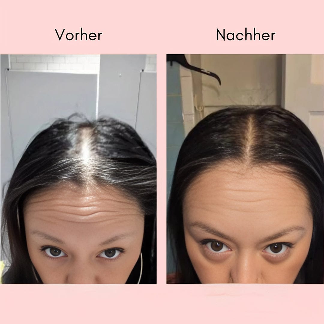 KraftKopfhaut™ / Natürliches Haaröl gegen sichtbaren Haarausfall & dünner werdendes Haar - Sopheria