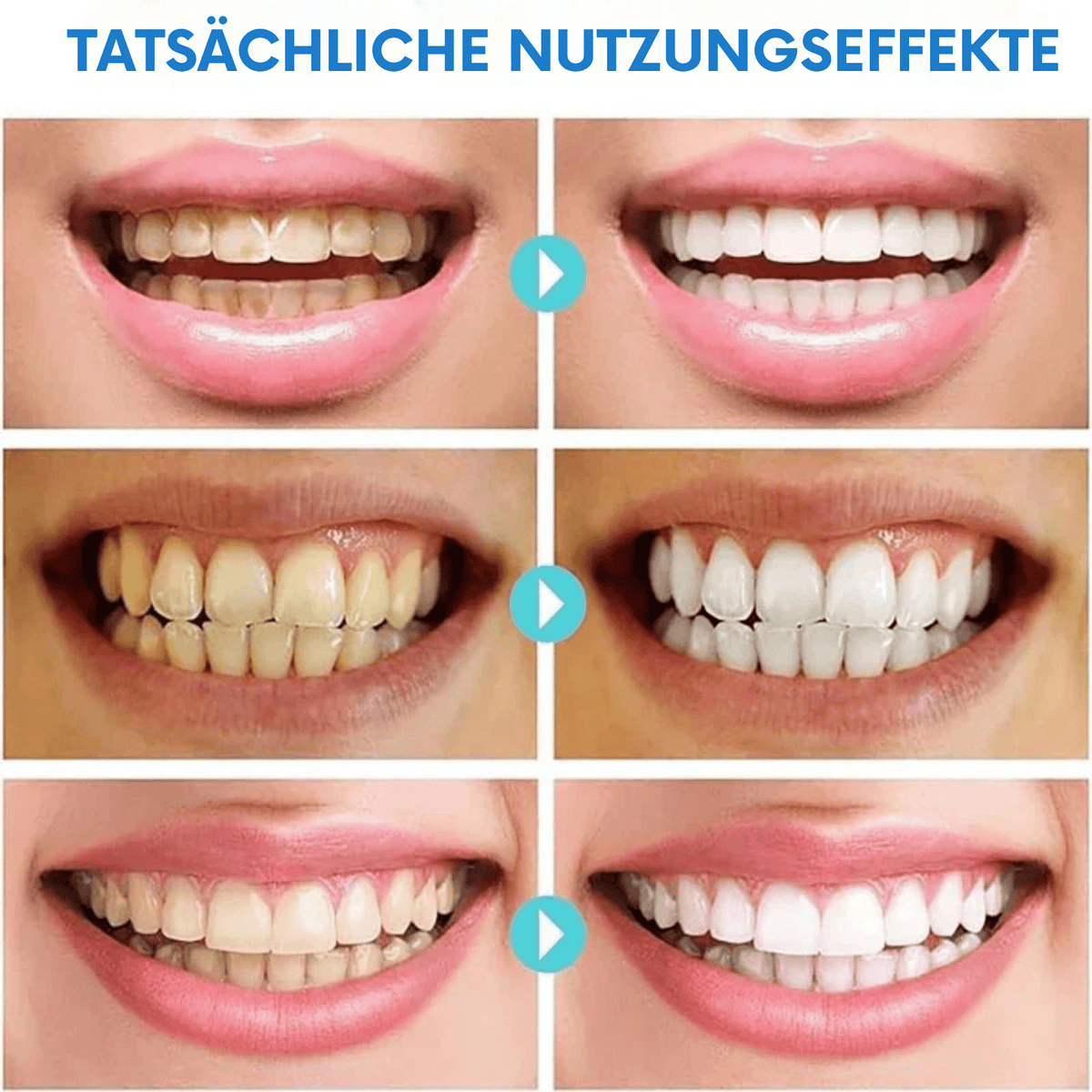 LächelLicht™ / Entfernt Hartnäckige Flecken - Sopheria