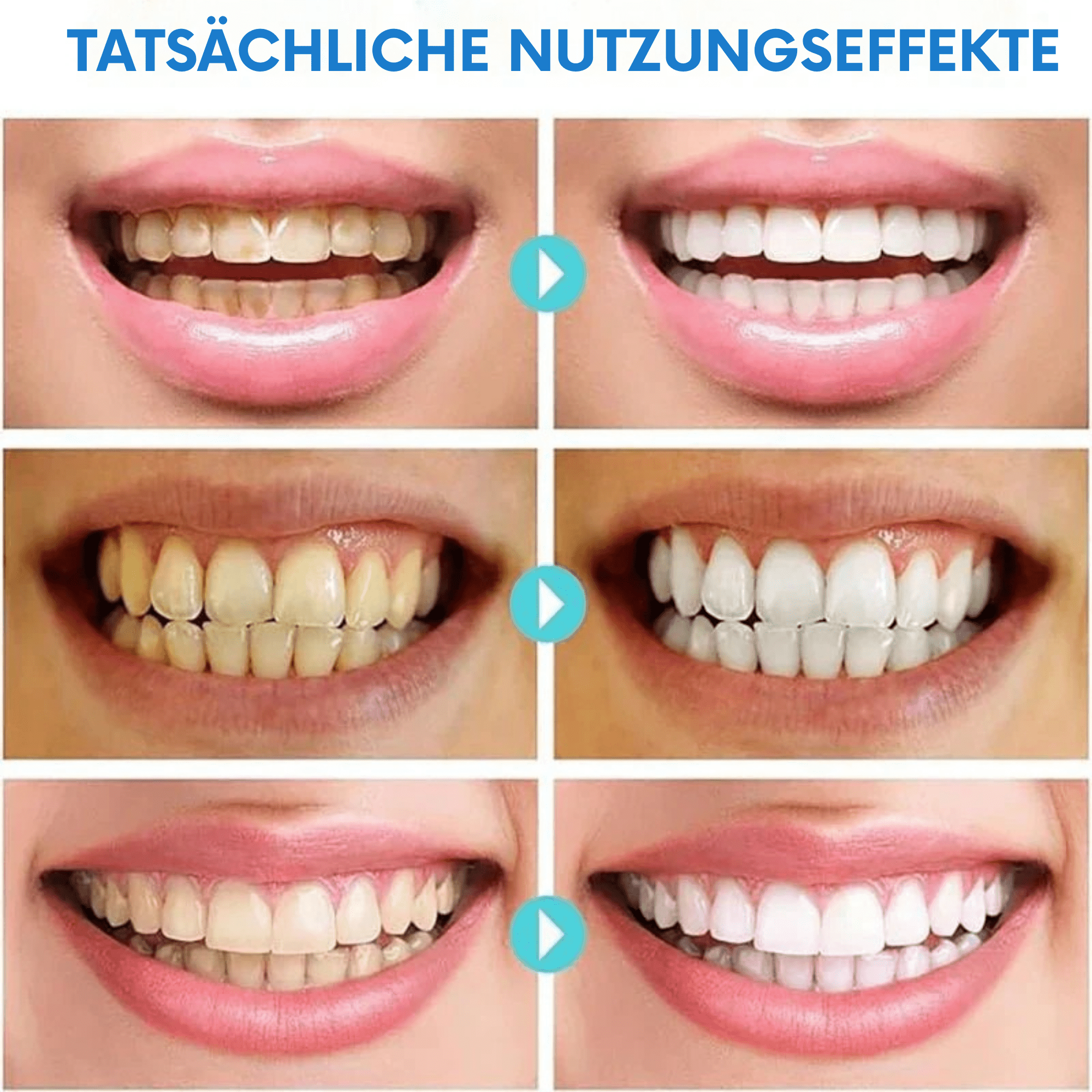 LächelLicht™ / Entfernt Hartnäckige Flecken - Sopheria