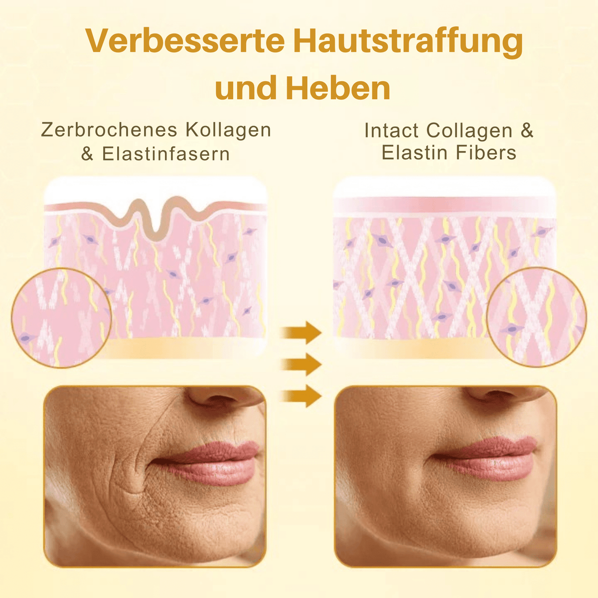 LiftingLuxux™ / Liftingcreme mit Bienengift (1+2 GRATIS) - Sopheria