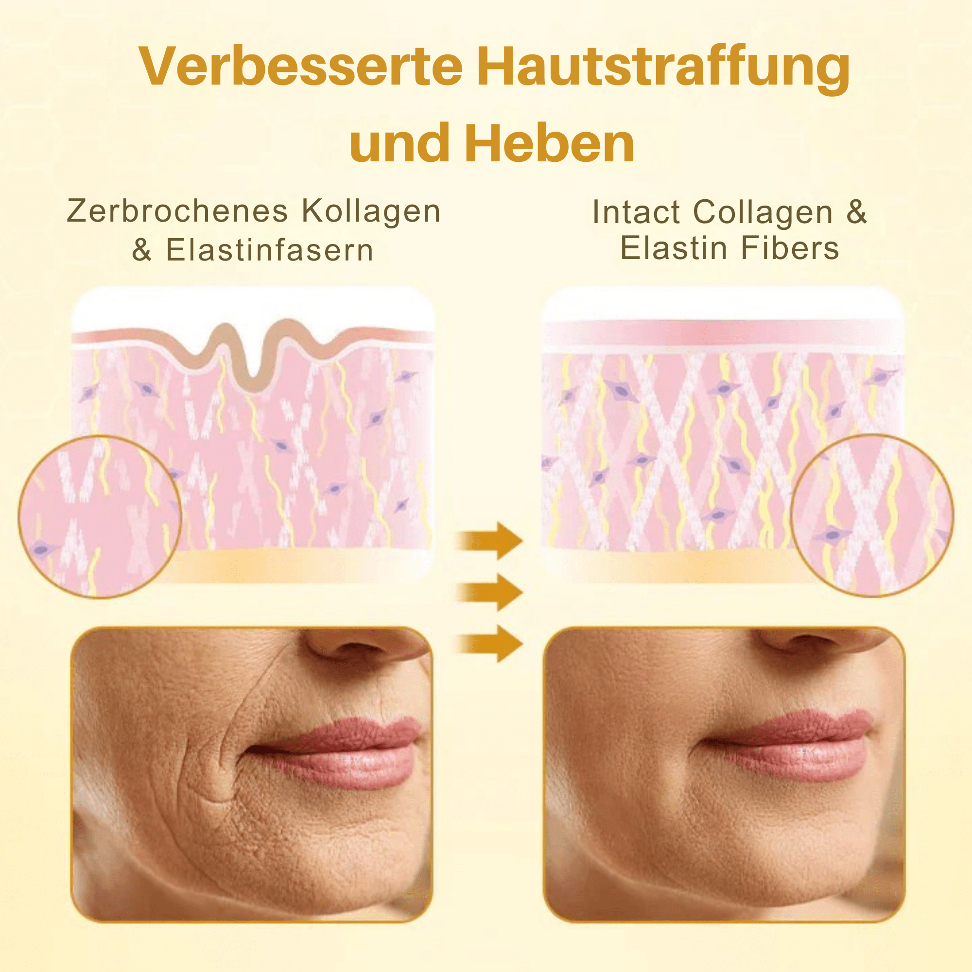 LiftingLuxux™ / Liftingcreme mit Bienengift (1+2 GRATIS) - Sopheria