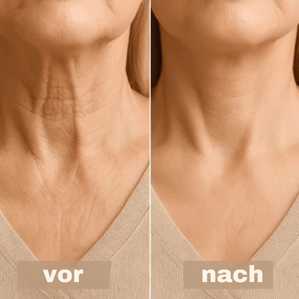 LiftLinie™ / Sofort-Nackenband zur Straffung und Glättung - Sopheria