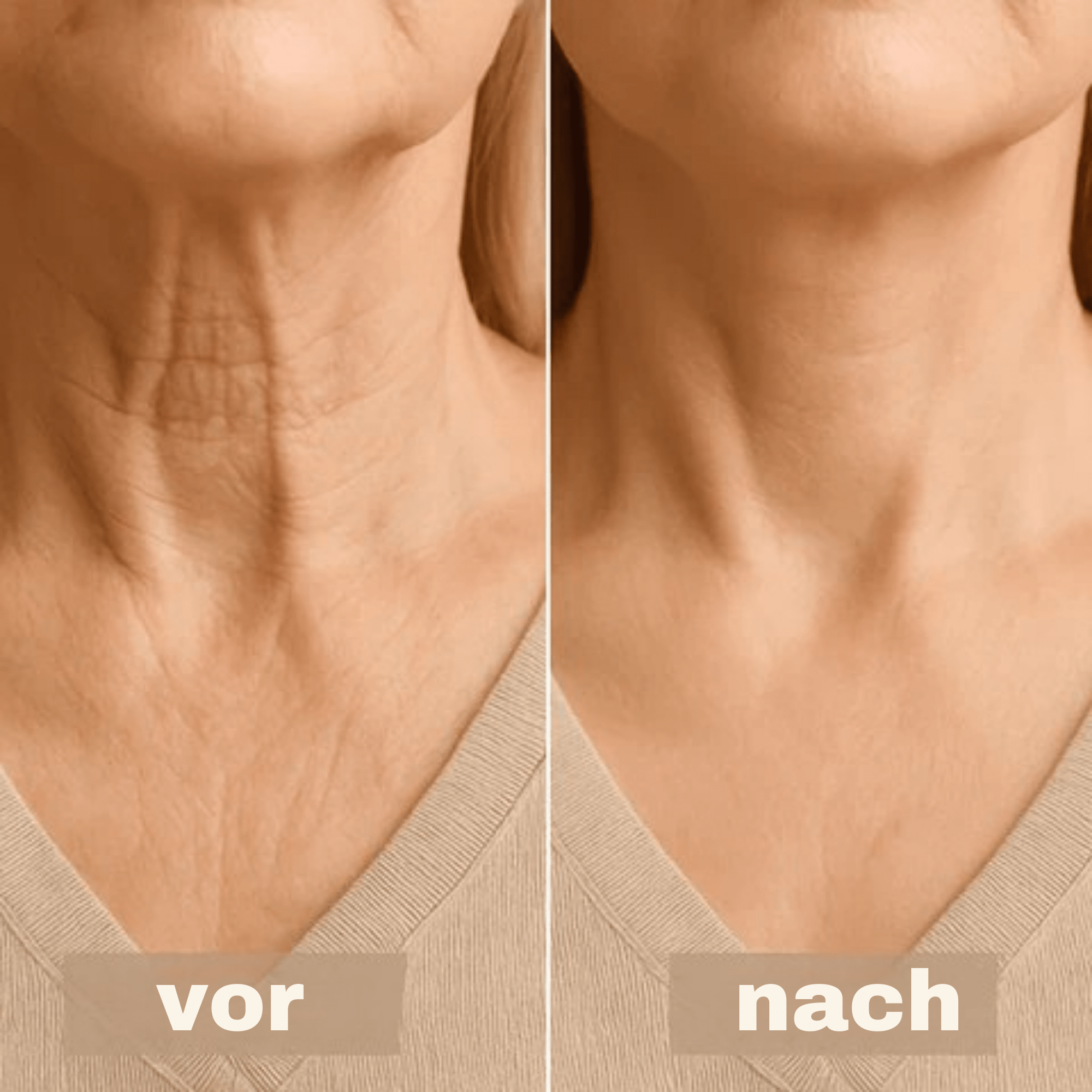 LiftLinie™ / Sofort-Nackenband zur Straffung und Glättung - Sopheria