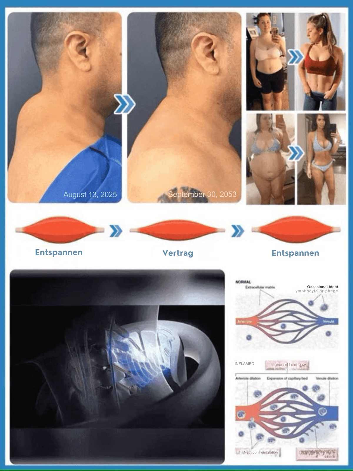 ﻿LymphLift™ / Ultraschall Lymphdrainagegerät - Cellulite & Fett Reduzieren - Muskelentspannung - Sopheria